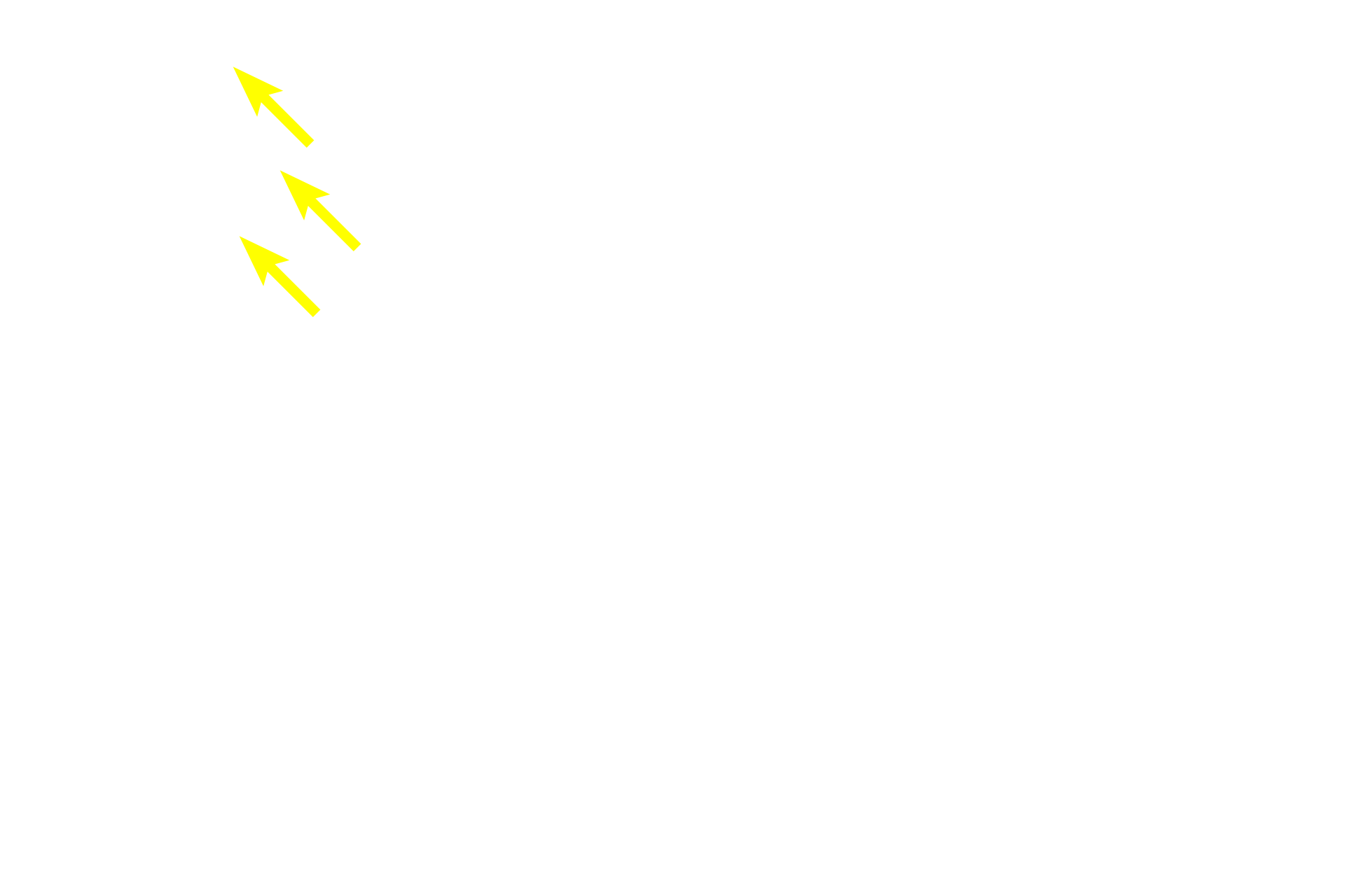  - Internal elastic lamina > <p>An internal elastic lamina is characteristic of arteries, but is lacking in all but the largest veins. The lamina appears wavy or folded due to postmortem shrinkage of the vessel.</p>
