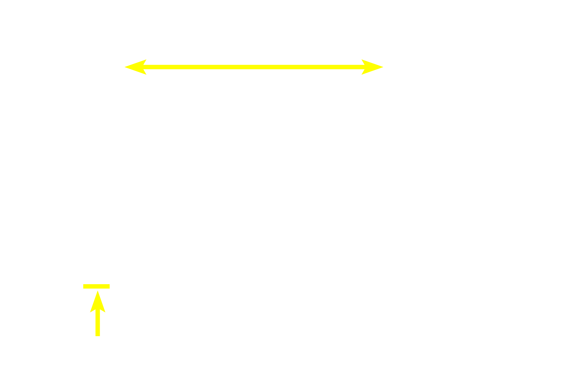 Tunica media > <p>As demonstrated in these medium-sized vessels, the tunica media of smooth muscle is the predominate layer in arteries.</p>
