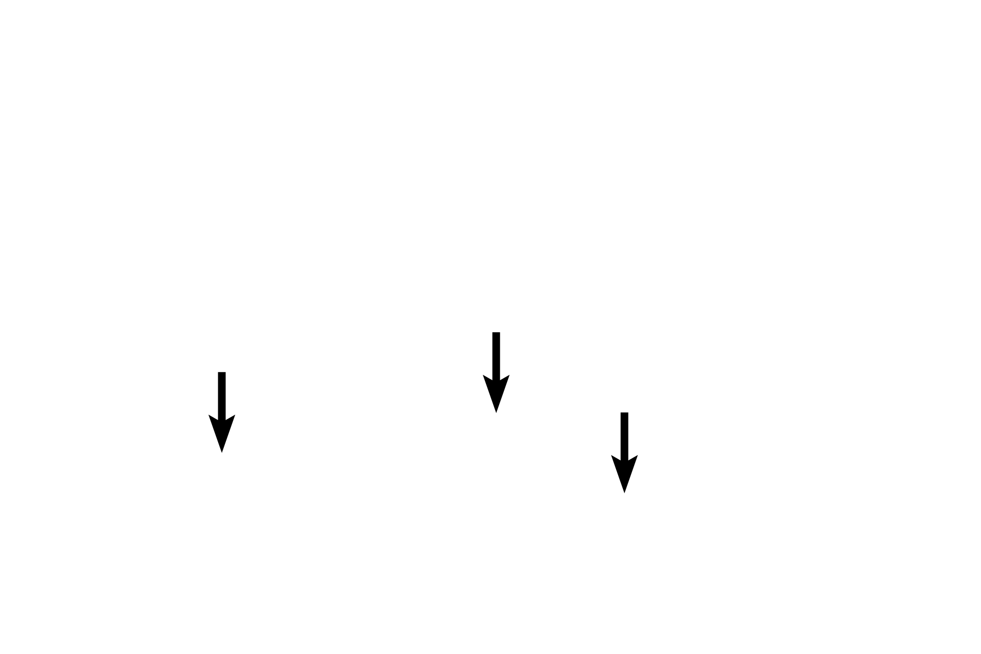 Endothelium <p>The features of a medium vein are better seen in this higher magnification image.  Most named veins are medium and large veins. 300x</p>
