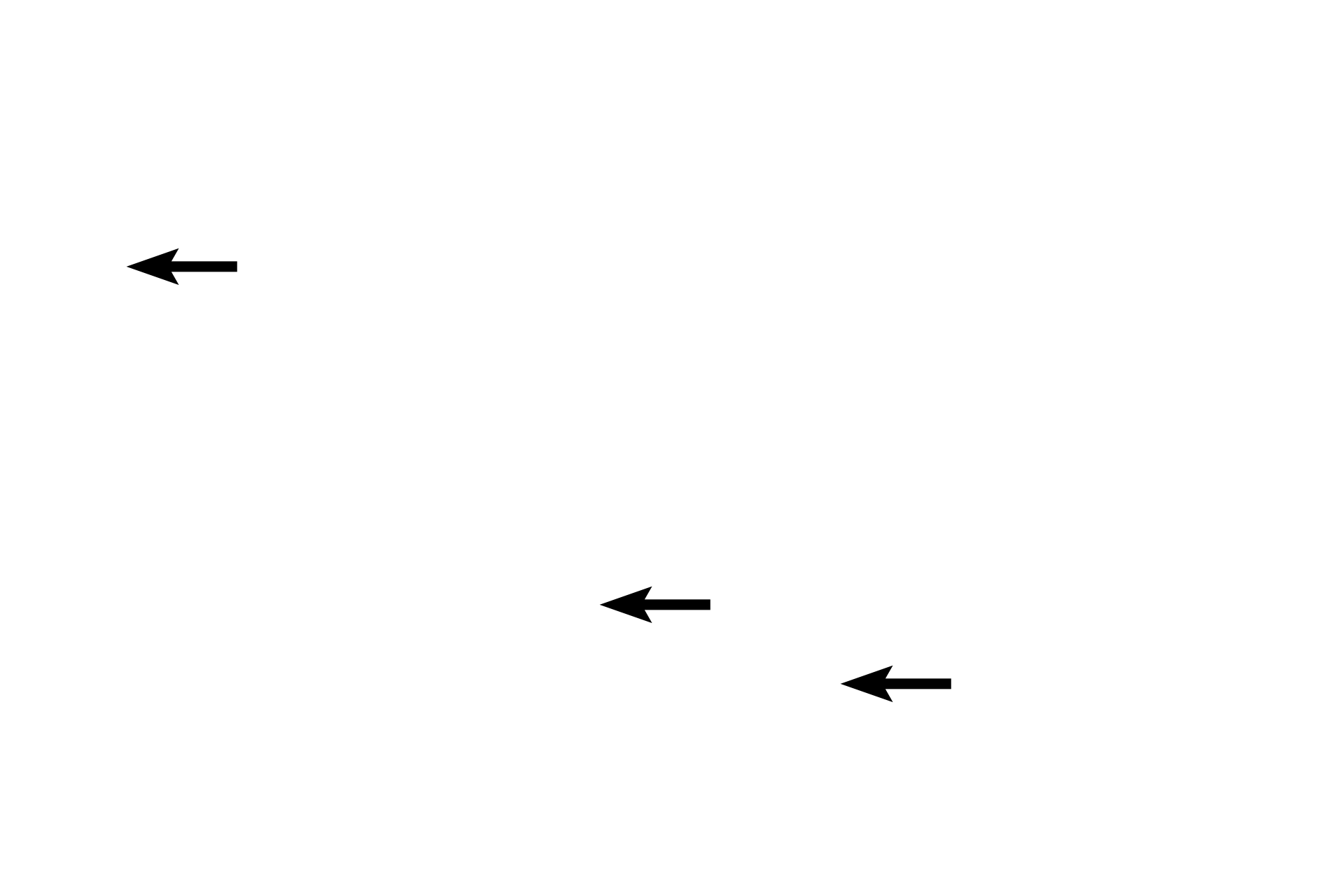 Tunica media <p>The features of a medium vein are better seen in this higher magnification image.  Most named veins are medium and large veins. 300x</p>
