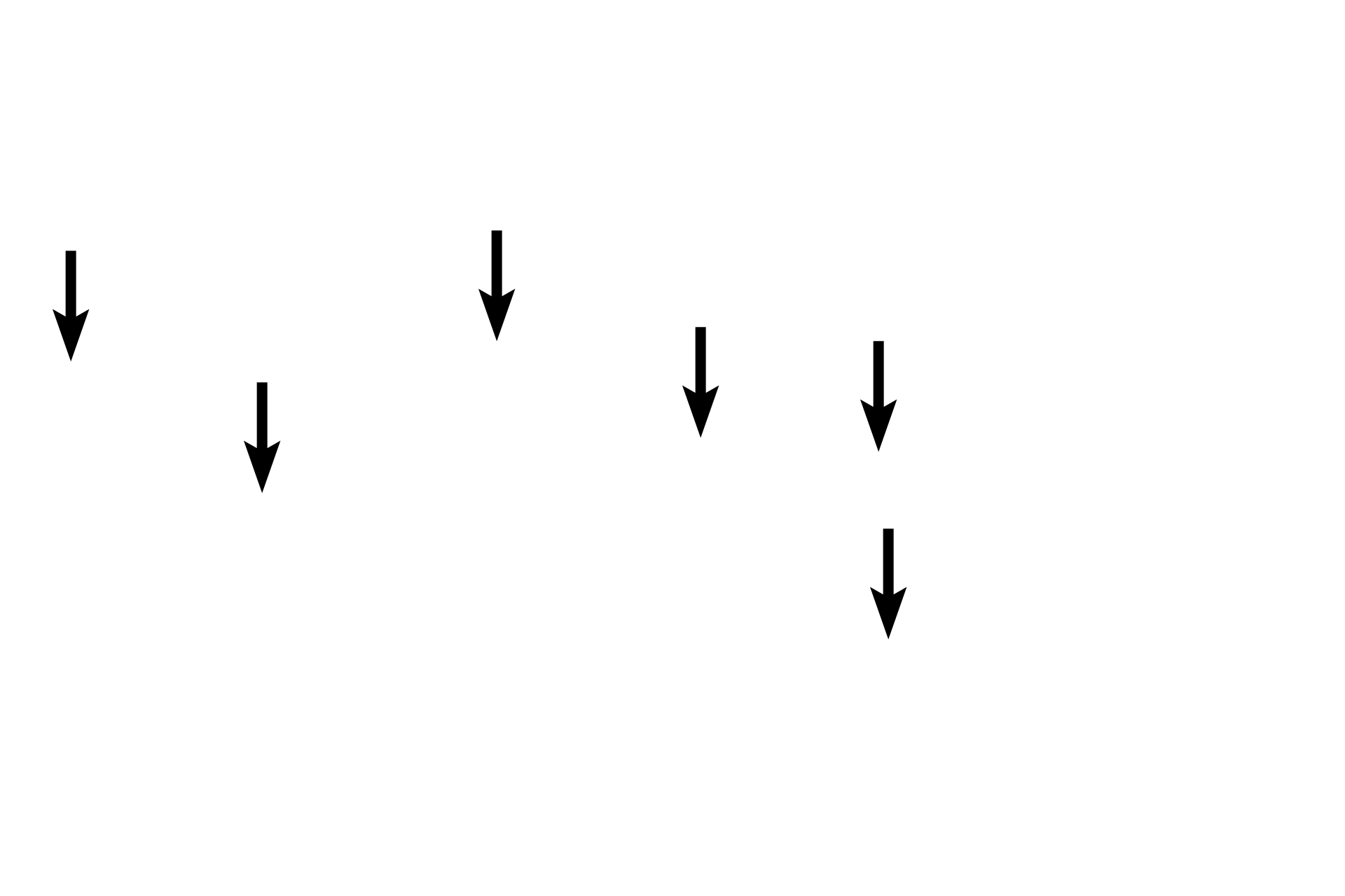 Valve leaflets <p>The features of a medium vein are better seen in this higher magnification image.  Most named veins are medium and large veins. 300x</p>
