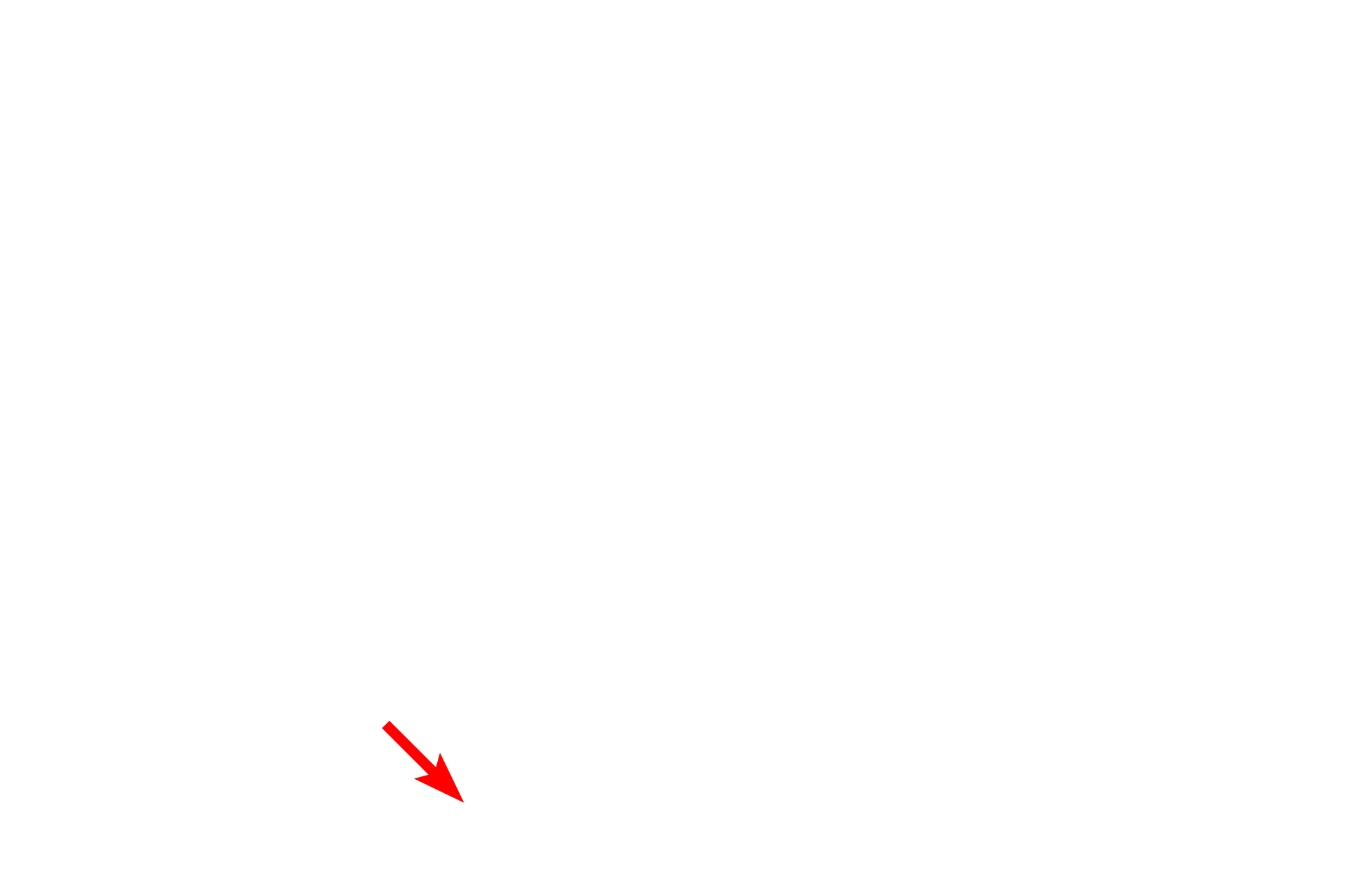 Capillary <p>This image shows a larger venule cut in longitudinal section.  Venules are composed of an endothelium and a thin subendothelial layer.  No additional tunics are present.  Venules resemble capillaries but have wider lumens.  They are a major site of fluid extravasation as well as migration of blood cells into the surrounding connective tissue (diapedesis).  Also visible are capillaries and a small arteriole.  Surrounding the vessels is loose connective tissue with elastic fibers cut in cross section.  1000x</p>
