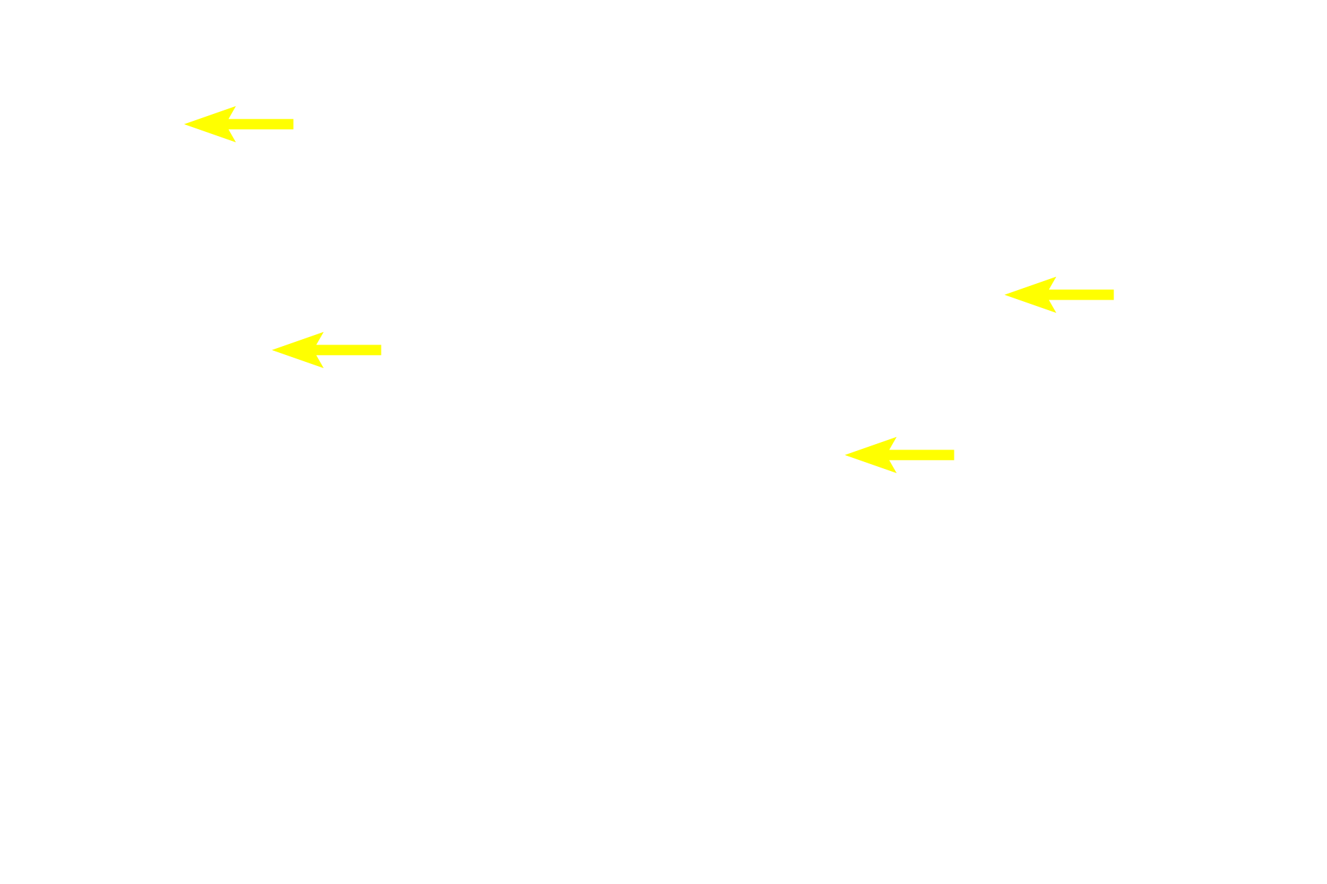 Tunica adventitia <p>Venules lead into small veins, which possess a thin tunica media, composed of scattered smooth muscle, and a prominent tunica adventitia.  Like venules, veins also possess valves.  The wall of the small vein is much thinner and less regular than that of the small artery it accompanies.  100x</p>
