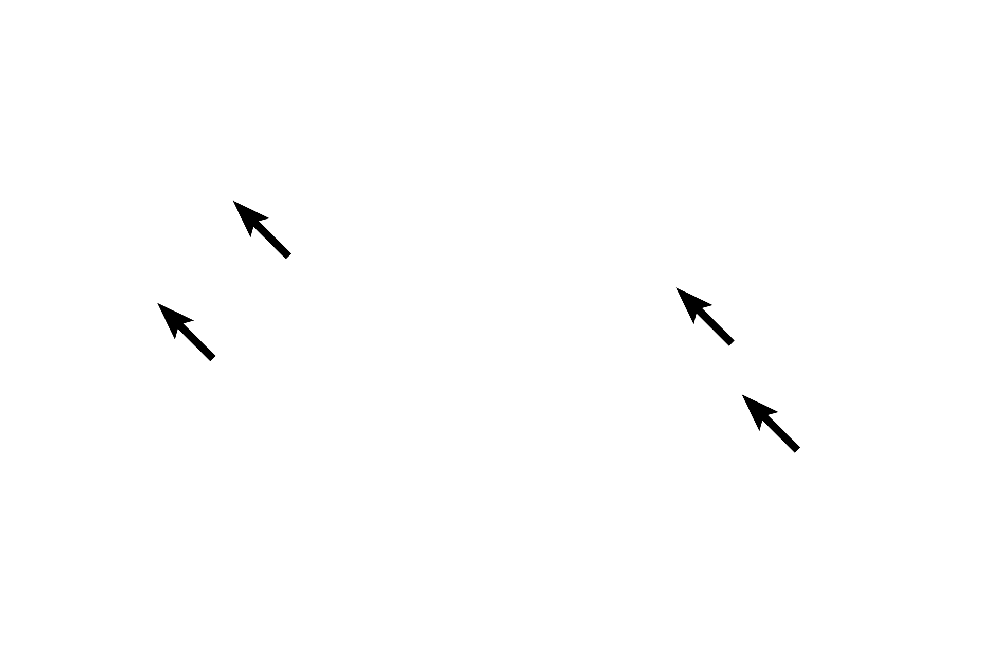 Tunica intima <p>Several criteria distinguish a medium vein from its accompanying medium (muscular) artery.  Veins possess wider lumens, thinner walls and more irregular outlines than do arteries; longitudinally-oriented smooth muscle may be present in the tunica adventitia of veins.  Additionally, veins possess valves, consisting of intimal folds, which are not present in arteries.  Arteries can also be distinguished by their dominant tunica media. 100x</p>
