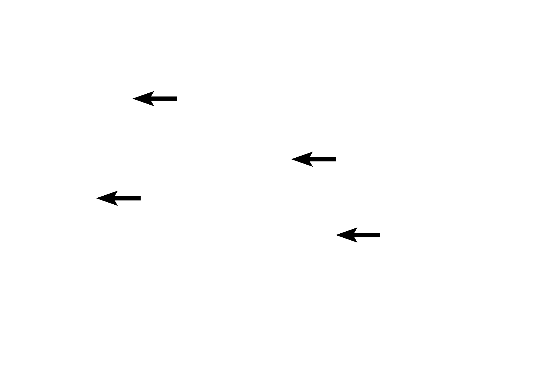 Tunica media <p>Several criteria distinguish a medium vein from its accompanying medium (muscular) artery.  Veins possess wider lumens, thinner walls and more irregular outlines than do arteries; longitudinally-oriented smooth muscle may be present in the tunica adventitia of veins.  Additionally, veins possess valves, consisting of intimal folds, which are not present in arteries.  Arteries can also be distinguished by their dominant tunica media. 100x</p>
