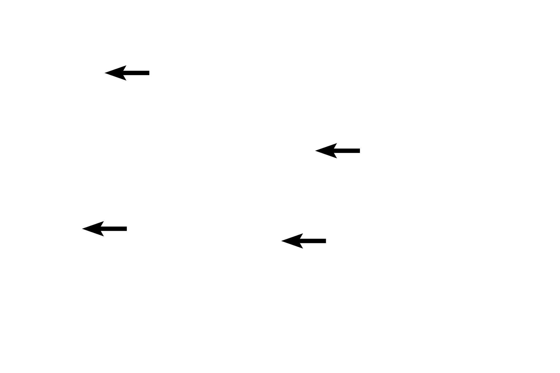 Tunica adventitia <p>Several criteria distinguish a medium vein from its accompanying medium (muscular) artery.  Veins possess wider lumens, thinner walls and more irregular outlines than do arteries; longitudinally-oriented smooth muscle may be present in the tunica adventitia of veins.  Additionally, veins possess valves, consisting of intimal folds, which are not present in arteries.  Arteries can also be distinguished by their dominant tunica media. 100x</p>
