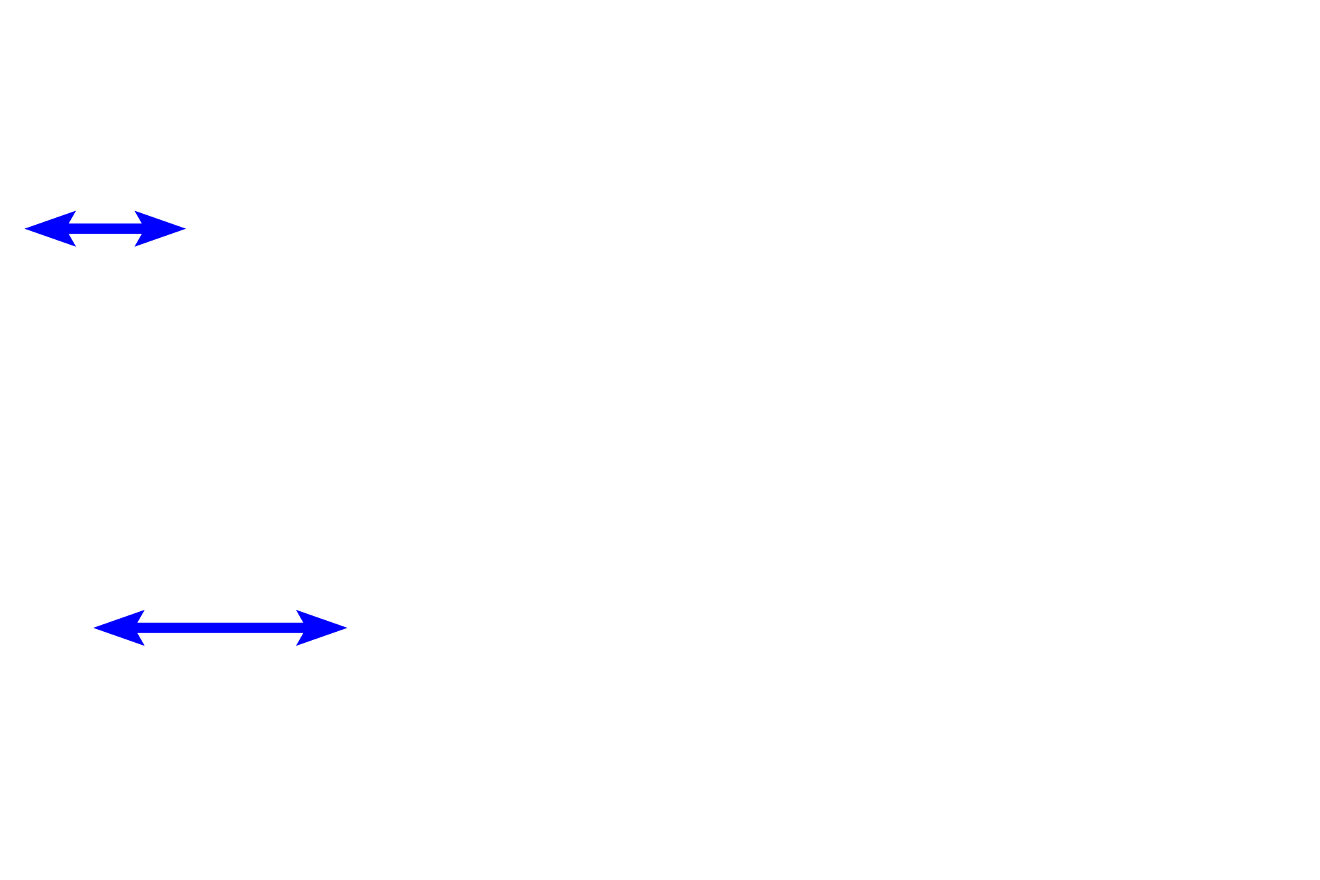 Capsule <p>Zona glomerulosa is located just beneath the dense, irregular connective tissue capsule and contains round clusters of cells.  Zona fasciculata, the middle layer, possesses typical steroid-secreting cells with a vacuolated cytoplasm produced by extraction of lipid during tissue processing.  These droplets contain cholesterol and other lipids for steroid hormone synthesis.  400x</p>
