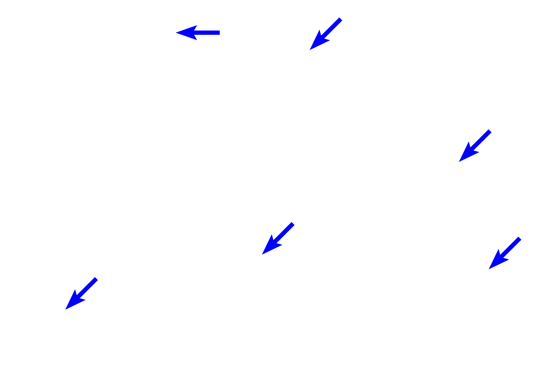  - Endothelial cells <p>The heavily vacuolated cells of zona fasciculata are arranged in uniform rows (fascicles), which alternate with wide-diameter, fenestrated capillaries.  The cells of zona reticularis form an interlacing network, are smaller and stain more intensely than cells in the zona fasciculata. Cells of zona reticularis are also surrounded by fenestrated capillaries.  400x</p>
