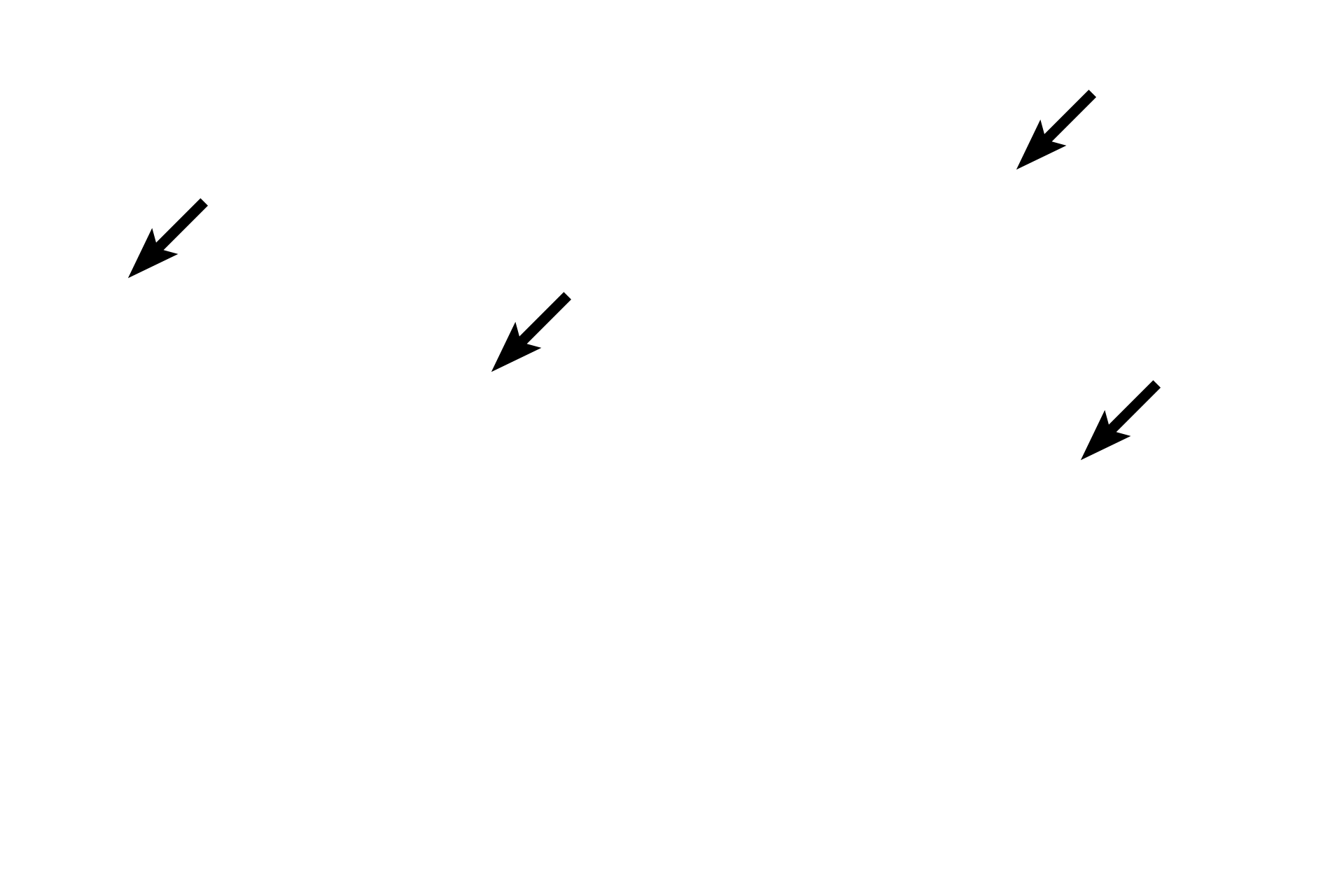  - Lipid droplets <p>Cells of zona fasciculata display the vacuolated cytoplasm resulting from the extraction of lipid during tissue processing.  In addition to the lipid droplets, these steroid-secreting cells also have mitochondria with tubular cristae, abundant SER and secrete by diffusion into the surrounding capillaries.  1000x</p>
