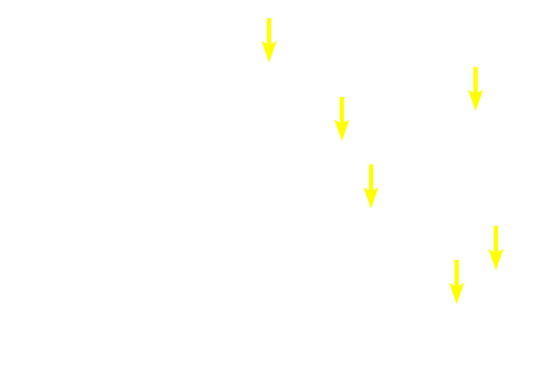  - Chromaffin cells <p>The interface between zona reticularis and adrenal medulla shows the medulla composed of chromaffin cells, modified sympathetic neurons.  Some blood percolates through the cortical zones before entering the medulla.  By this circulatory pattern, glucocorticoids influence norepinephrine synthesis in the chromaffin cells.  400x</p>
