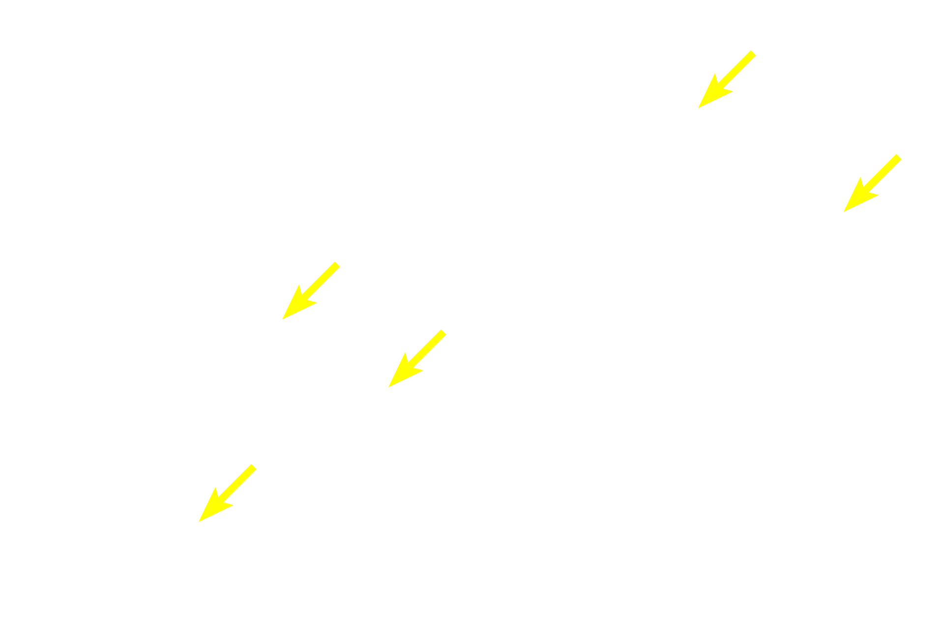 Chromaffin cells <p>The adrenal medulla is composed of chromaffin cells, modified neurons that contain secretory granules with the catecholamines, epinephrine and norepinephrine.  Although these neurohormones are produced by different cell populations in the medulla, the individual cells cannot be distinguished in this H&E stained section.  1000x</p>
