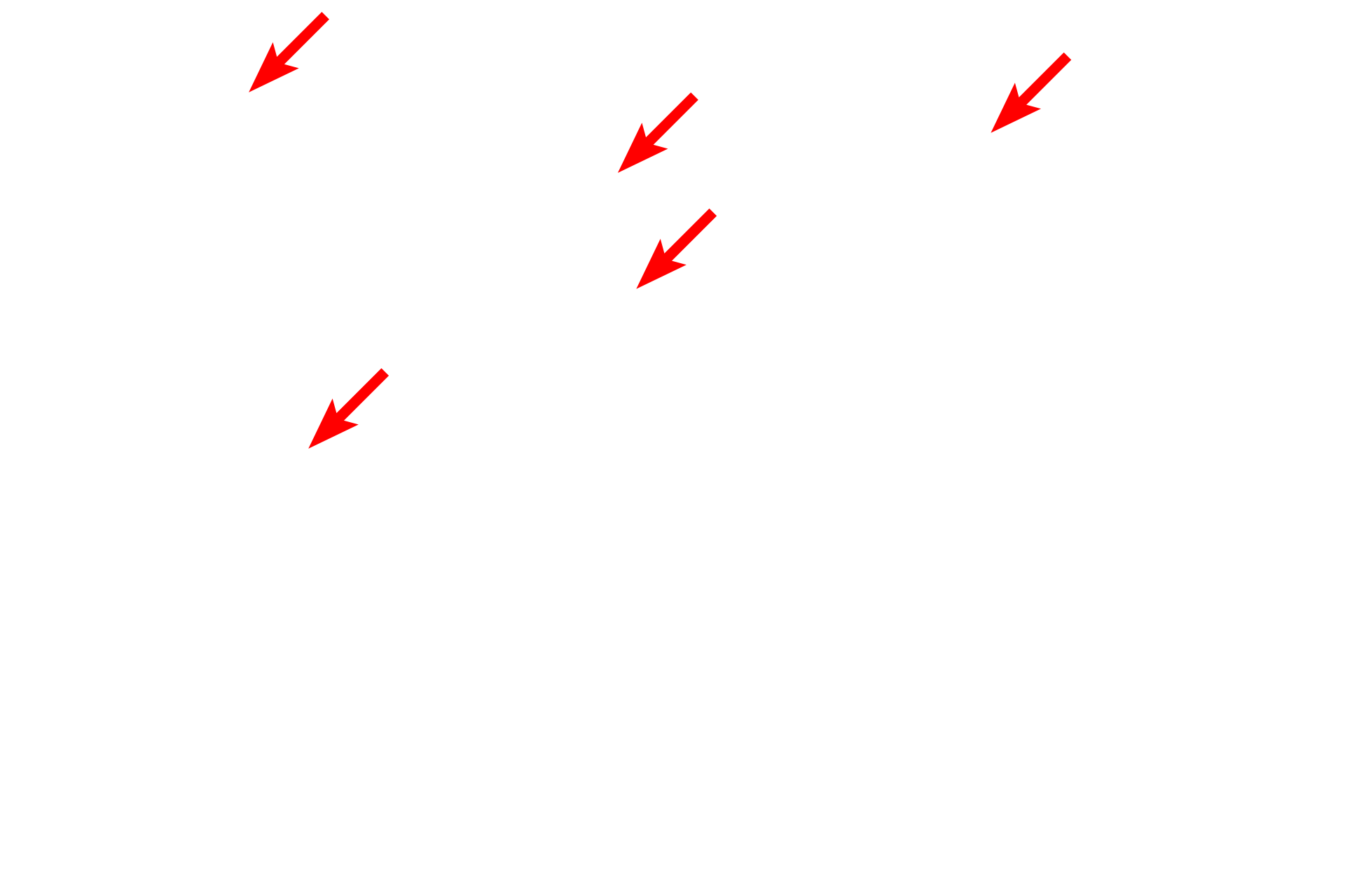  - Chief cell secretory granules <p>Chief cells, the source of digestive enzymes in the stomach, are exocrine gland cells. Their secretory granules are oriented toward the lumen of the gland by which they gain access to stomach contents.</p>
