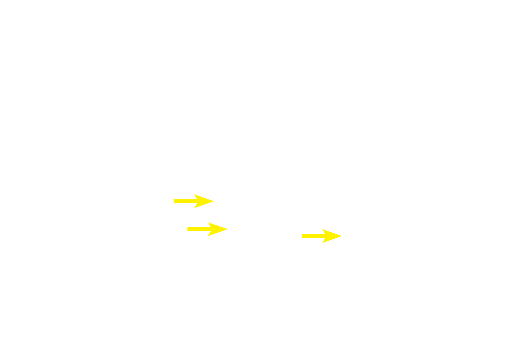  - Enteroendocrine cells <p>Enteroendocrine cells, seen here in the intestinal glands of the small intestines, secrete their hormones into the connective tissue of the surrounding lamina propria.  Therefore, the secretory granules in these cells are located adjacent to the basement membrane of the glands. Paneth cells are exocrine cells and their secretory granules lie adjacent to the lumen of the gland, into which they secrete.  1000x</p>
