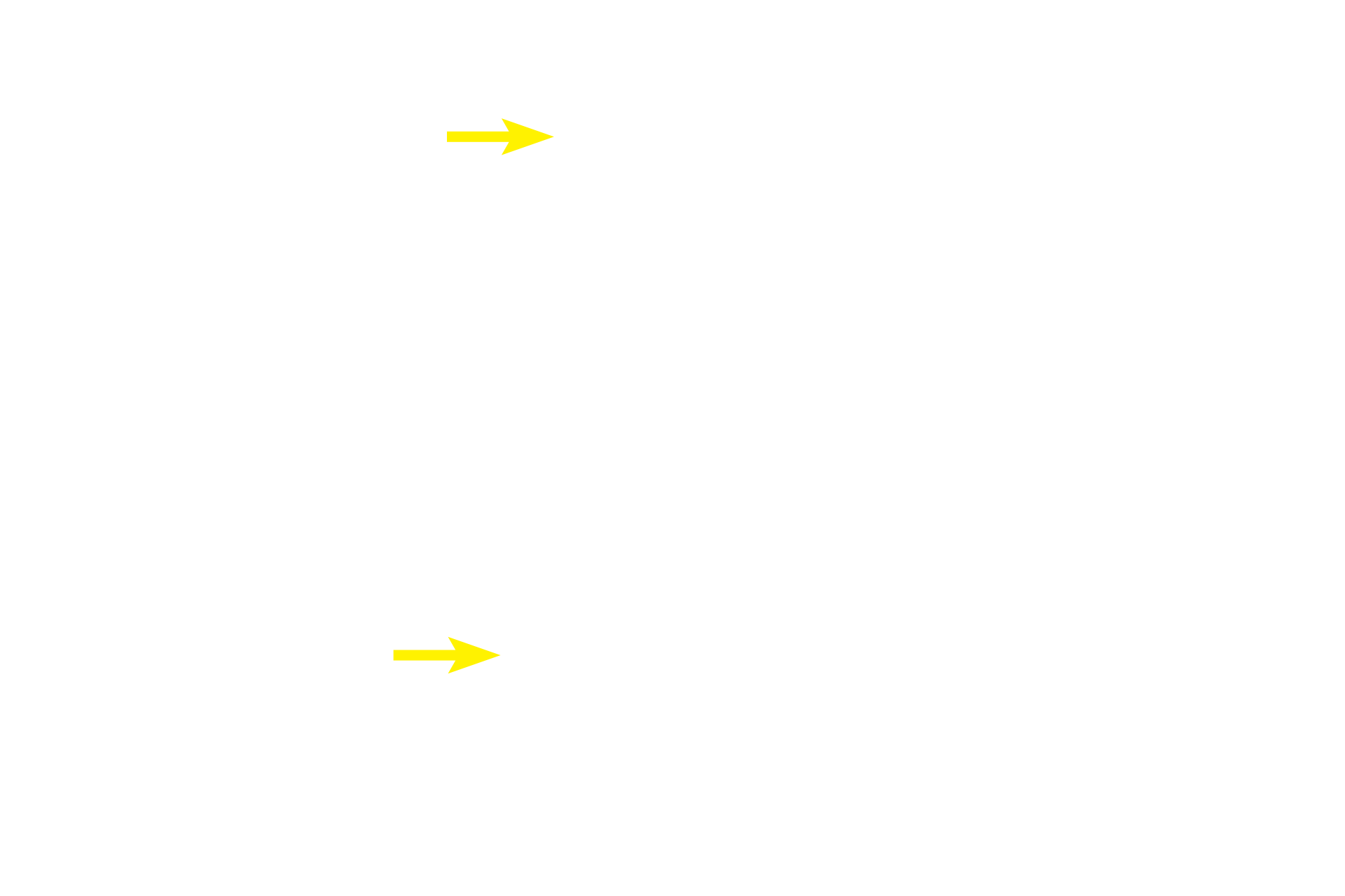  - Paneth cells <p>Enteroendocrine cells, seen here in the intestinal glands of the small intestines, secrete their hormones into the connective tissue of the surrounding lamina propria.  Therefore, the secretory granules in these cells are located adjacent to the basement membrane of the glands. Paneth cells are exocrine cells and their secretory granules lie adjacent to the lumen of the gland, into which they secrete.  1000x</p>
