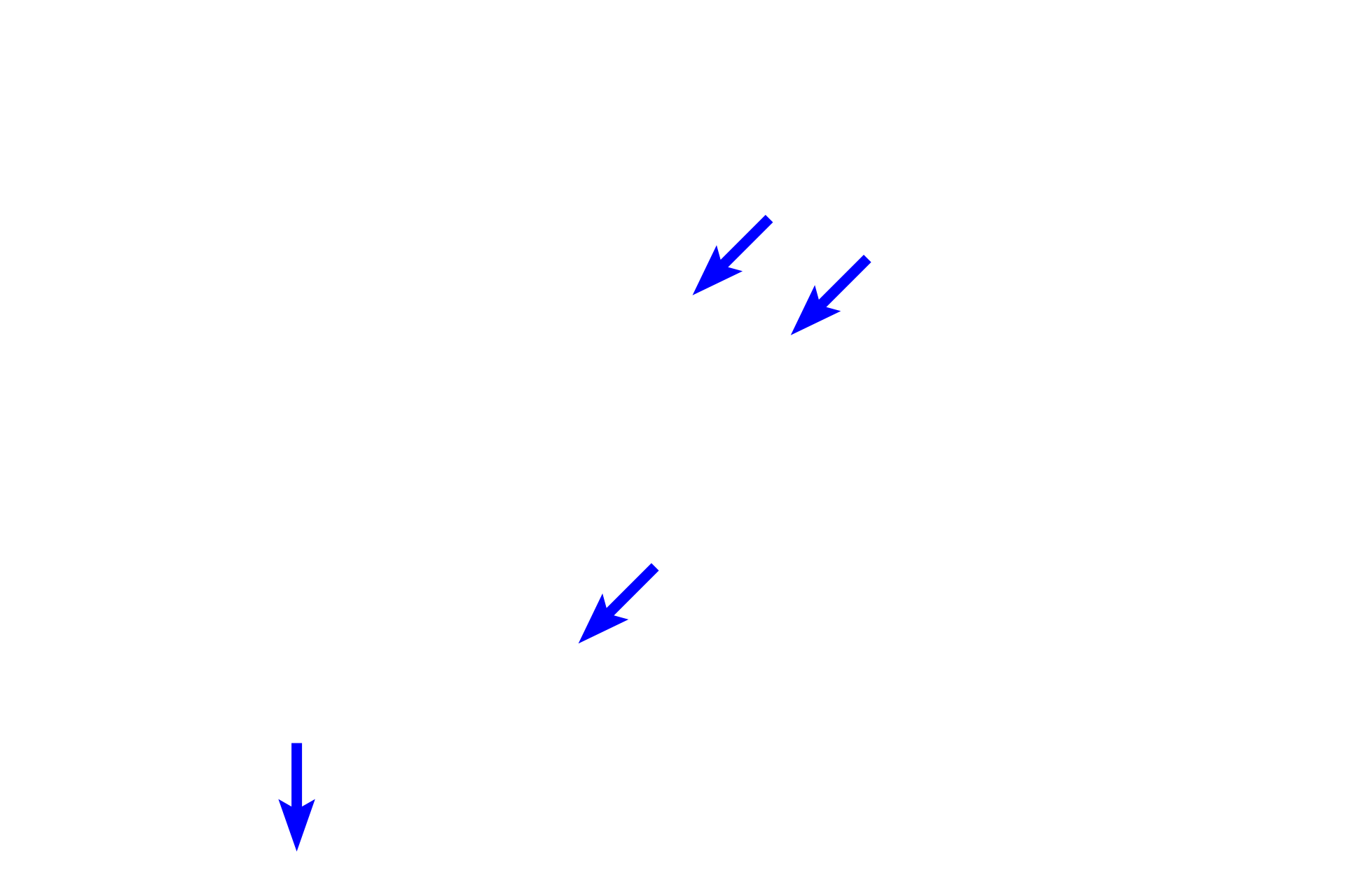 Blood vessels and lymphatics <p>Clusters of steroid-secreting cells (called Leydig cells) are located between the seminiferous tubules of the testis, where they secrete androgens.  The cytoplasm of these cells is filled with the lipid droplets typical of steroid-secreting cells.  The ovary in the female also contains clusters of steroid-secreting cells.  400x</p>
