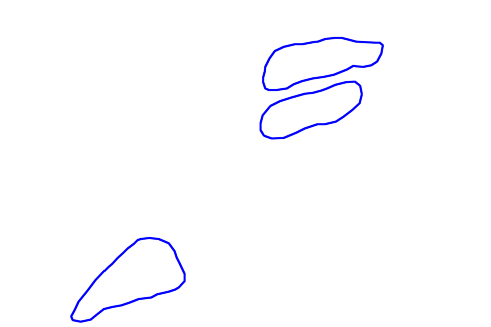 Leydig cells <p>This higher magnification shows a small cluster of androgen-secreting, Leydig cells located in the connective tissue between the seminiferous tubules of the testis.  These are steroid-secreting cells and, hence, large numbers of lipid droplets fill the cytoplasm.  1000x</p>
