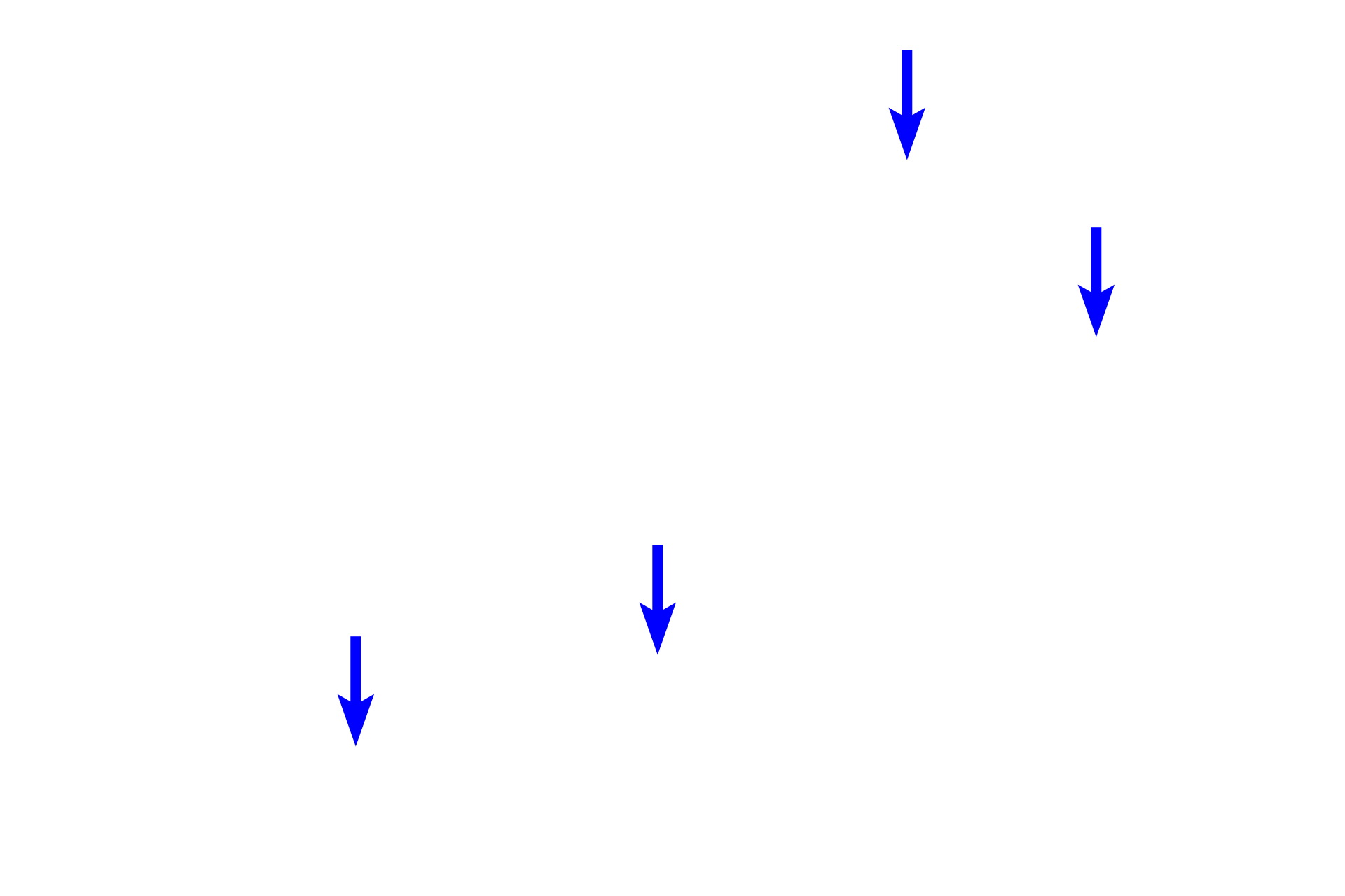 - Lipid droplets <p>This higher magnification shows a small cluster of androgen-secreting, Leydig cells located in the connective tissue between the seminiferous tubules of the testis.  These are steroid-secreting cells and, hence, large numbers of lipid droplets fill the cytoplasm.  1000x</p>
