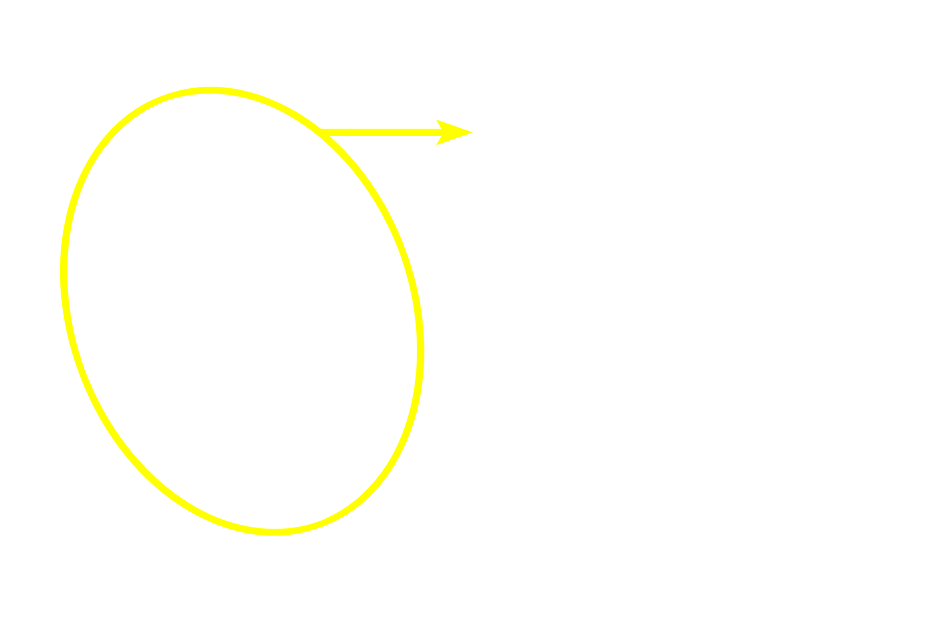 Islet of Langerhans <p>Islets of Langerhans are clusters of peptide-producing cells scattered throughout the exocrine pancreas.  With a special stain (on right), two subclasses of islet cells can be identified.  Glucagon is produced by alpha cells (red cells) and insulin, by beta cells (blue cells).  Delta cells, secreting somatostatin, cannot be identified here.  400x, 1000x</p>
