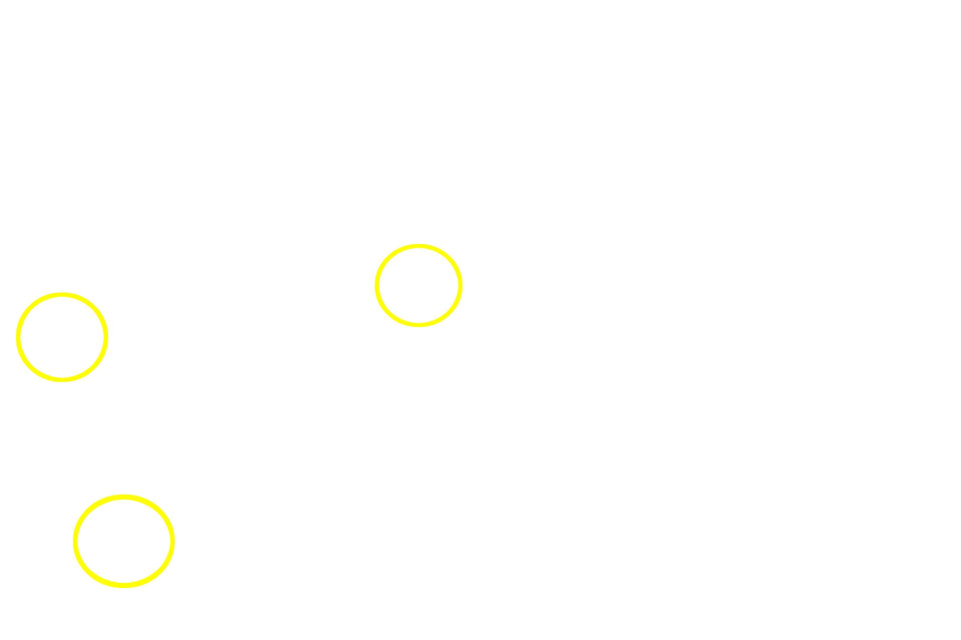 Acini of exocrine pancreas <p>Islets of Langerhans are clusters of peptide-producing cells scattered throughout the exocrine pancreas.  With a special stain (on right), two subclasses of islet cells can be identified.  Glucagon is produced by alpha cells (red cells) and insulin, by beta cells (blue cells).  Delta cells, secreting somatostatin, cannot be identified here.  400x, 1000x</p>
