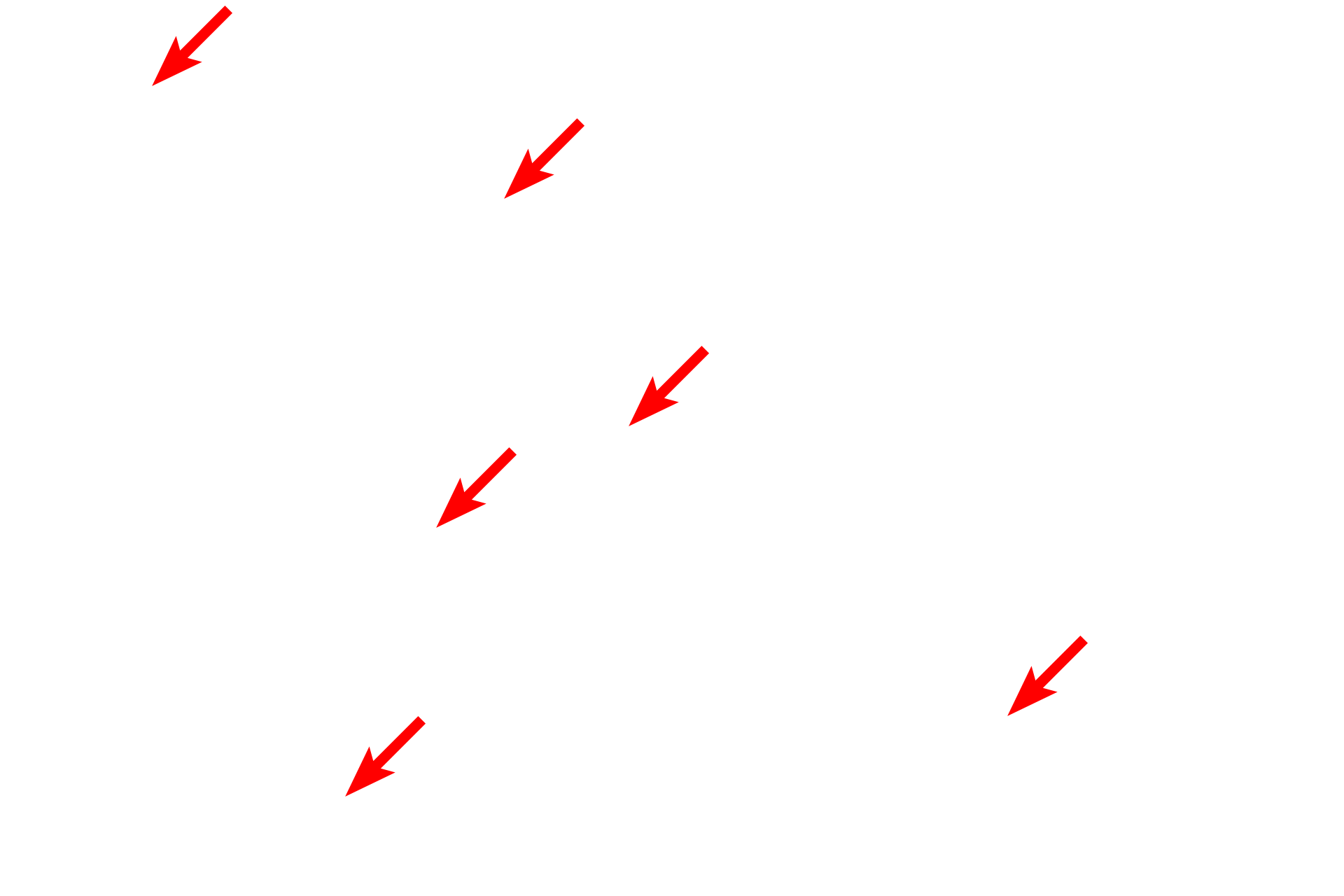  - Secretory granules <p>This electron micrograph shows endocrine cells which secrete a peptide hormone.  Hormone is stored in secretory granules and released into the extracellular space via the merocrine mode of secretion.  The close association of these cells with a nearby fenestrated capillary facilitates the rapid entry of the hormones into the circulation.  Endocrine pancreas  12,000x</p>
