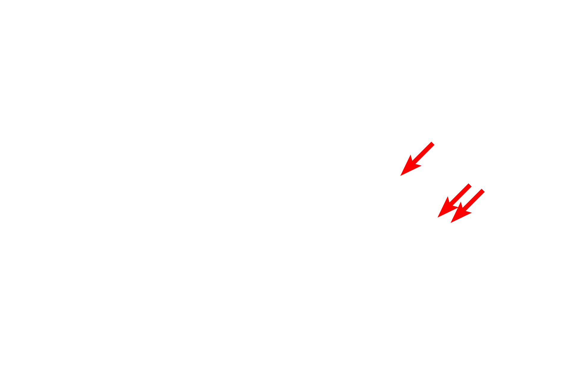  - Fenestrated endothelium <p>This electron micrograph shows endocrine cells which secrete a peptide hormone.  Hormone is stored in secretory granules and released into the extracellular space via the merocrine mode of secretion.  The close association of these cells with a nearby fenestrated capillary facilitates the rapid entry of the hormones into the circulation.  Endocrine pancreas  12,000x</p>
