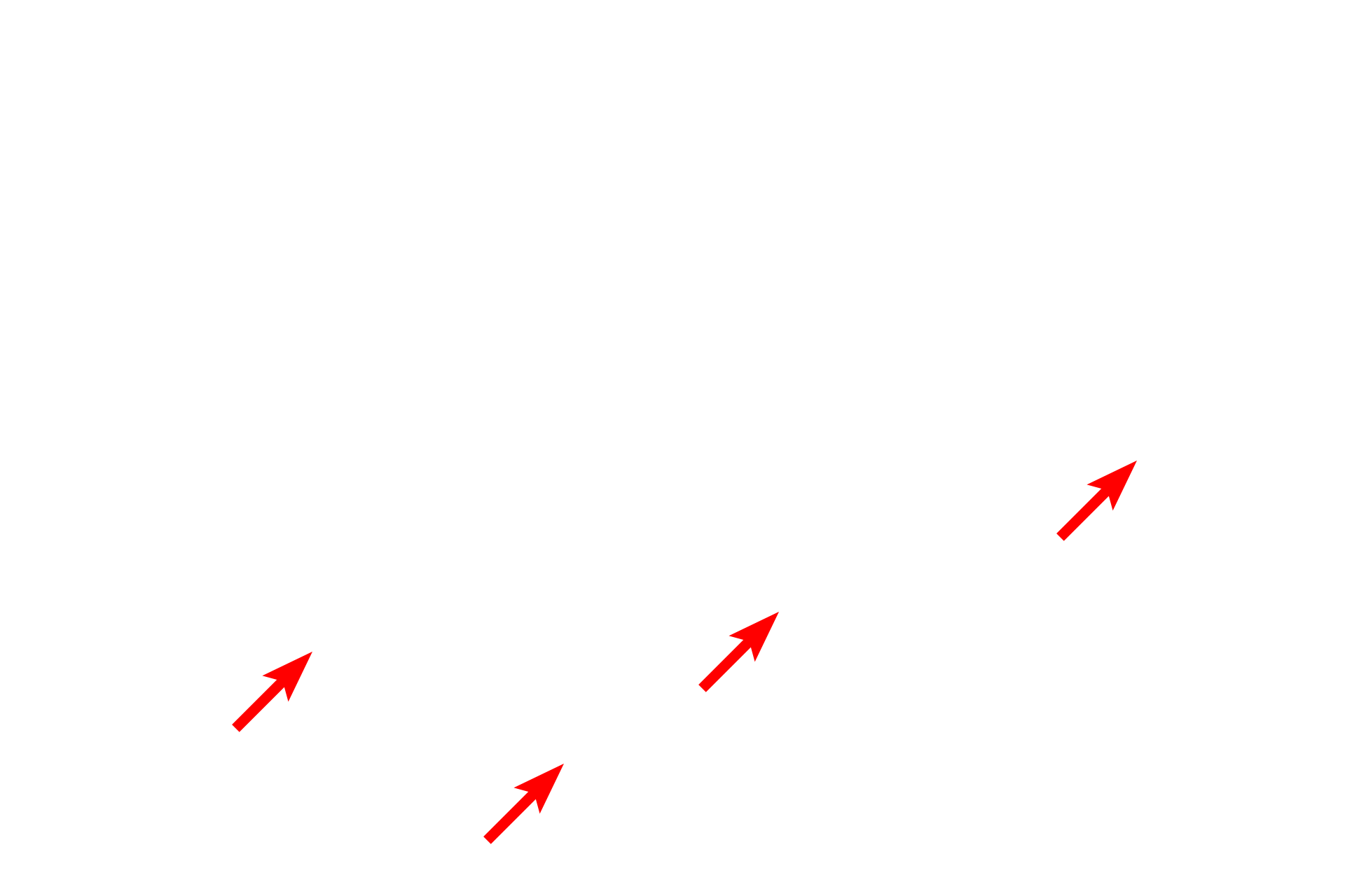  - Secretory granules <p>Clusters of endocrine cells and endocrine organs are supplied by fenestrated capillaries, which greatly facilitate the entry of hormone into the blood stream.  In endocrine organs these fenestrations have a nonmembranous diaphragm across the opening.  Endocrine pancreas  28,000x</p>
