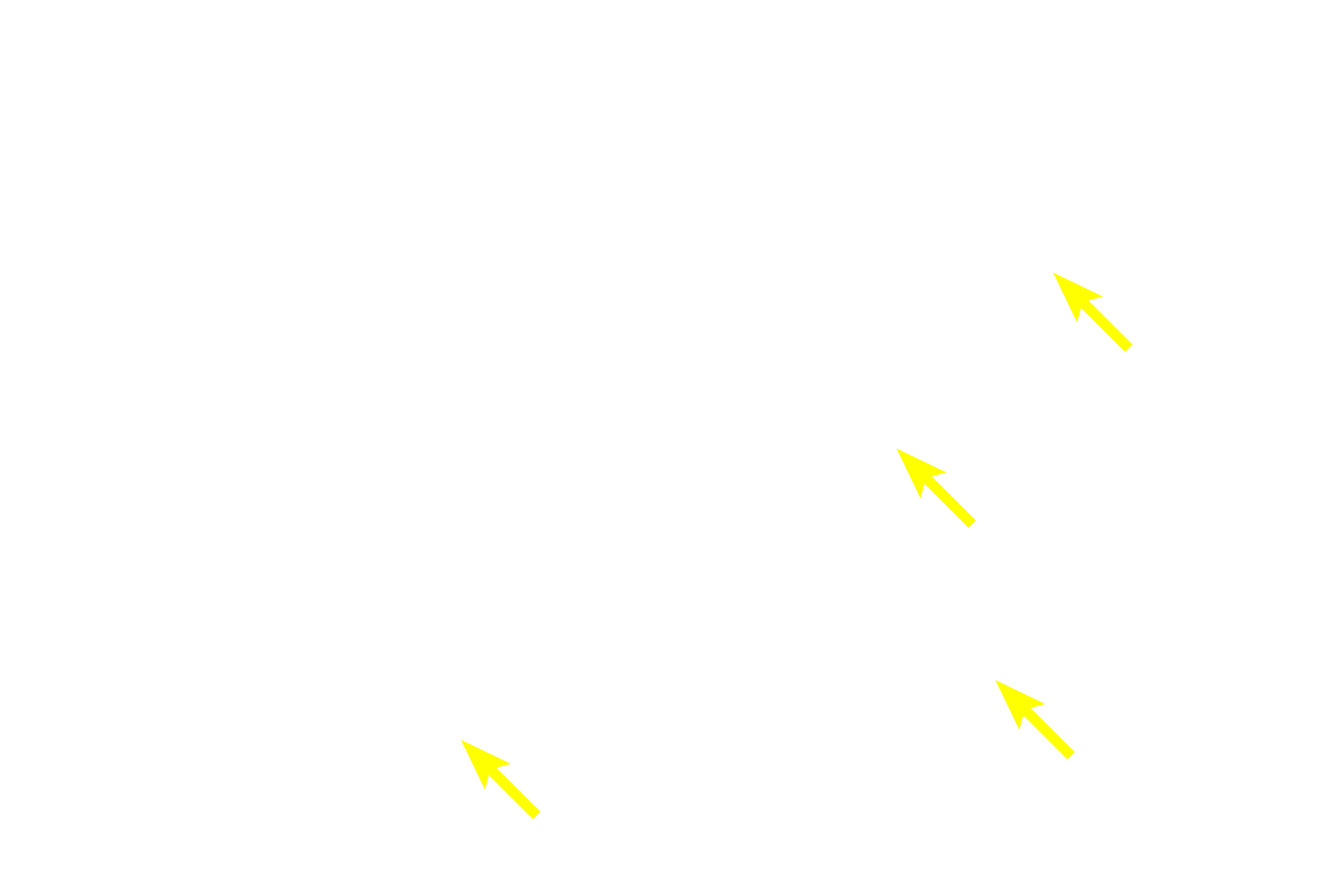 Principal cells <p>Chief, or principal, cells are small, polygonal cells with centrally located nuclei.  Oxyphil cells can be clearly distinguished from the principal cells by their larger size and abundant, eosinophilic cytoplasm.  Note the large number of capillaries between the rows of chief and oxyphil cells.  1000x</p>
