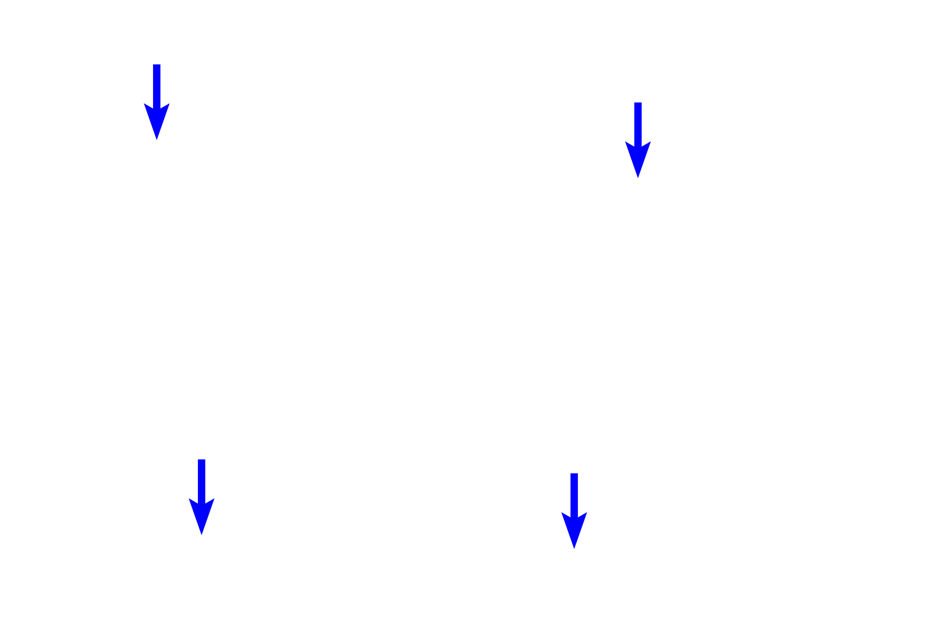 Capillaries <p>Chief, or principal, cells are small, polygonal cells with centrally located nuclei.  Oxyphil cells can be clearly distinguished from the principal cells by their larger size and abundant, eosinophilic cytoplasm.  Note the large number of capillaries between the rows of chief and oxyphil cells.  1000x</p>
