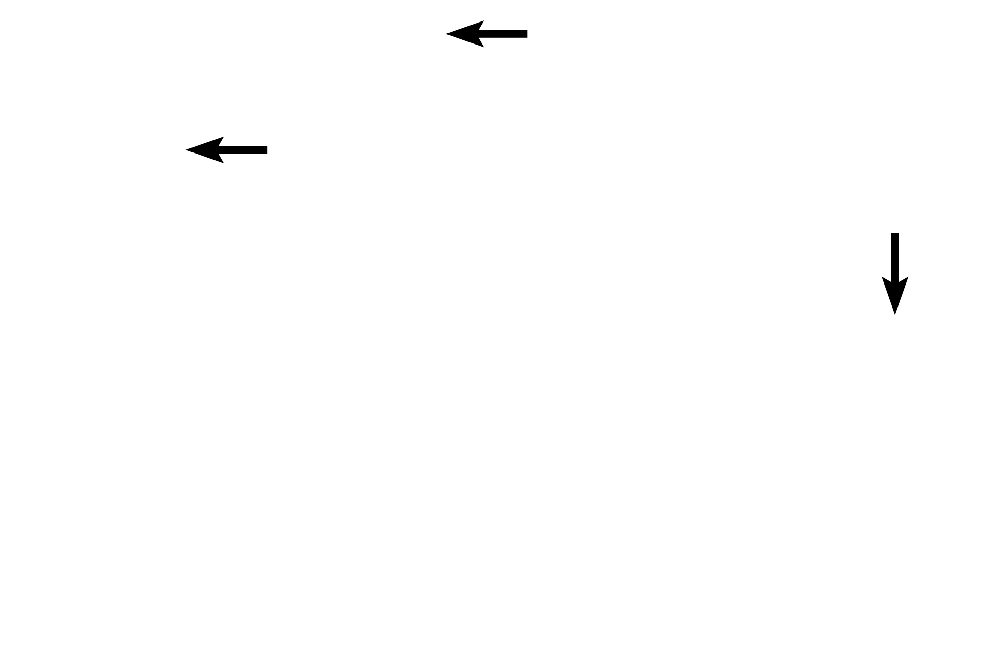 Blood vessels <p>The conical-shaped pineal gland, or epiphysis cerebri, is attached by the pineal stalk to the roof of the diencephalon of the brain, from which it develops.  The gland is surrounded by a capsule of pia mater and arachnoid elements; connective tissue septa penetrate the gland, subdividing it into indistinct lobules.  The pineal secretes melatonin, which regulates circadian rhythms.  100x.</p>
