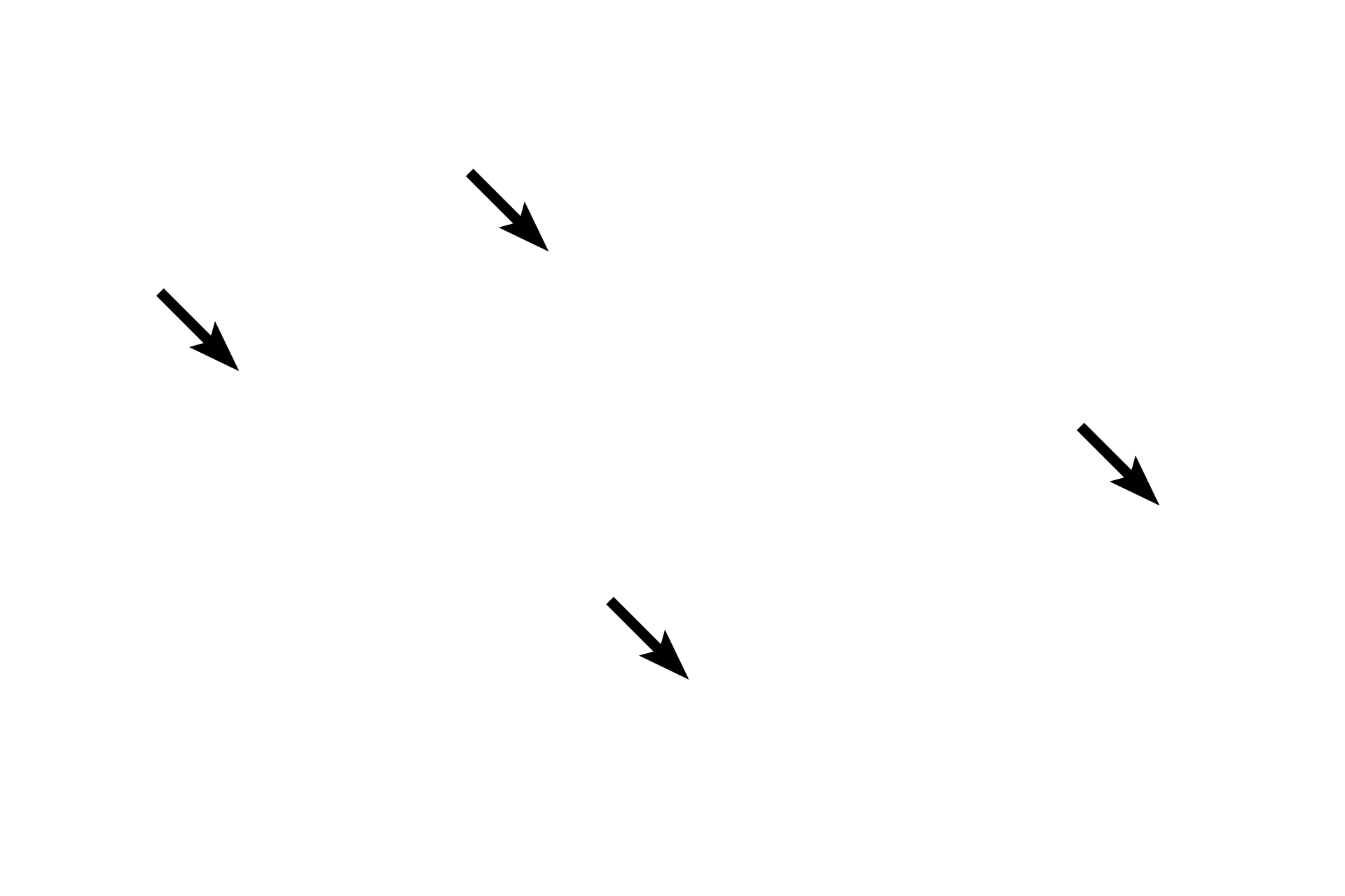 Pinealocytes > <p>The major cell type of the pineal gland is the pinealocyte, a modified neuron.  The main secretory product of pinealocytes is melatonin, which regulates light-dark cycles (circadian rhythms).</p>
