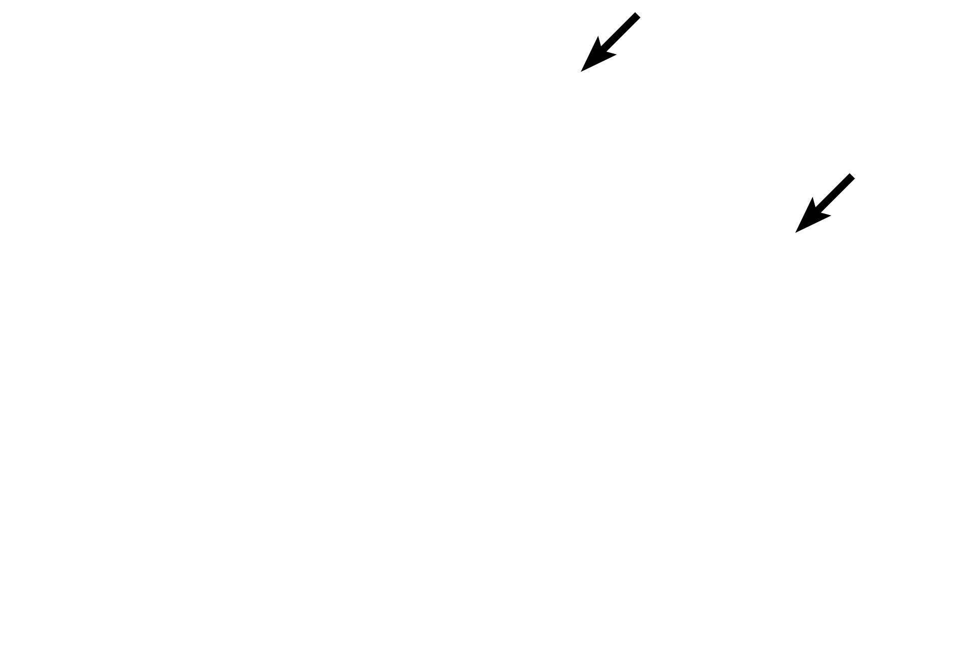 Capsule <p>The conical-shaped pineal gland, or epiphysis cerebri, is attached by the pineal stalk to the roof of the diencephalon of the brain, from which it develops.  The gland is surrounded by a capsule of pia mater and arachnoid elements; connective tissue septa penetrate the gland, subdividing it into indistinct lobules.  The pineal secretes melatonin, which regulates circadian rhythms.  100x.</p>

