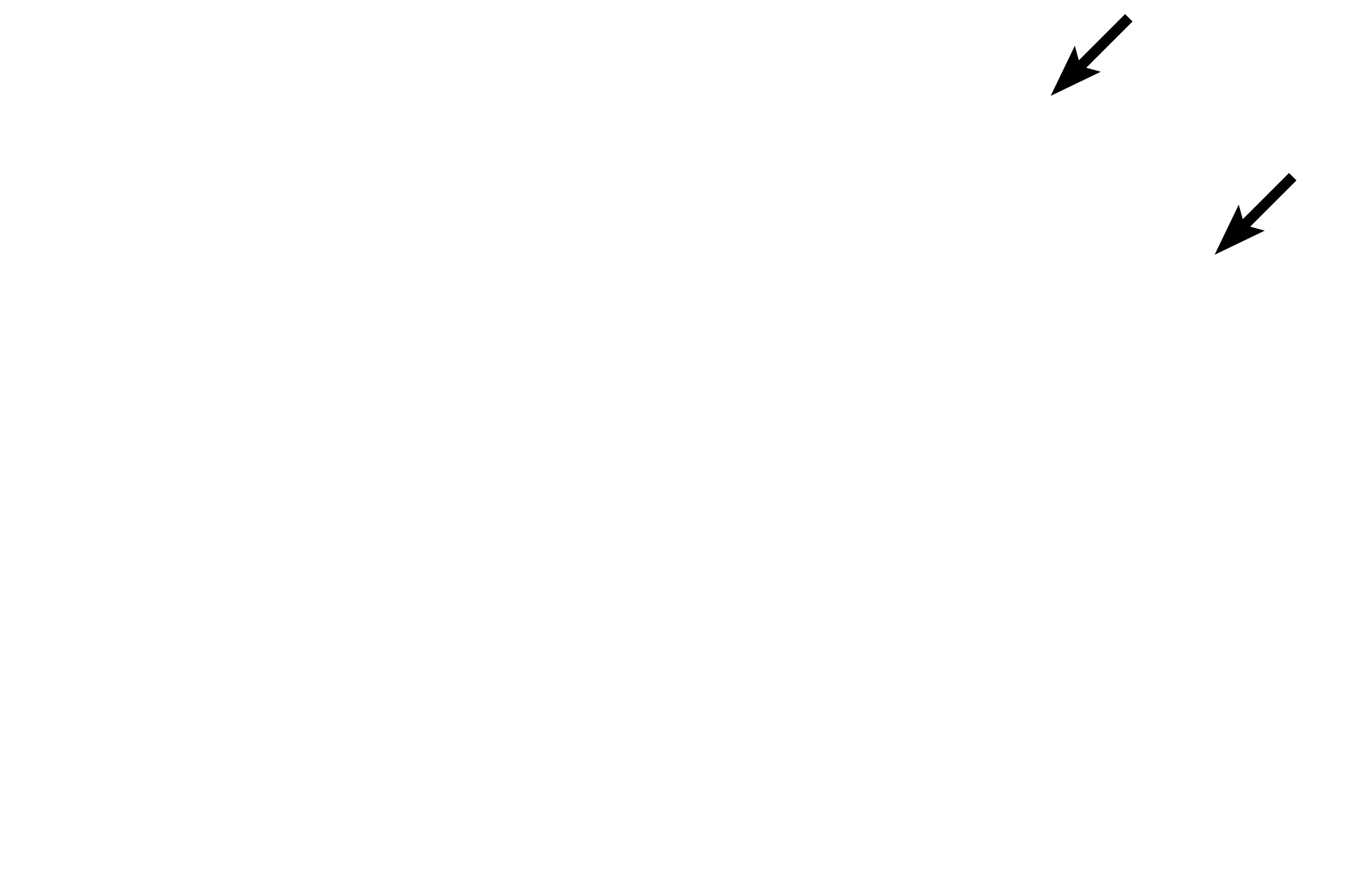 Pia mater capsule <p>Higher magnification of the pineal gland shows pinealocytes arranged in poorly defined lobules.  Connective tissue septa, extending from the pia mater capsule, penetrate the parenchyma of the gland.  Also visible is a corpus arenaceum.  200x</p>
