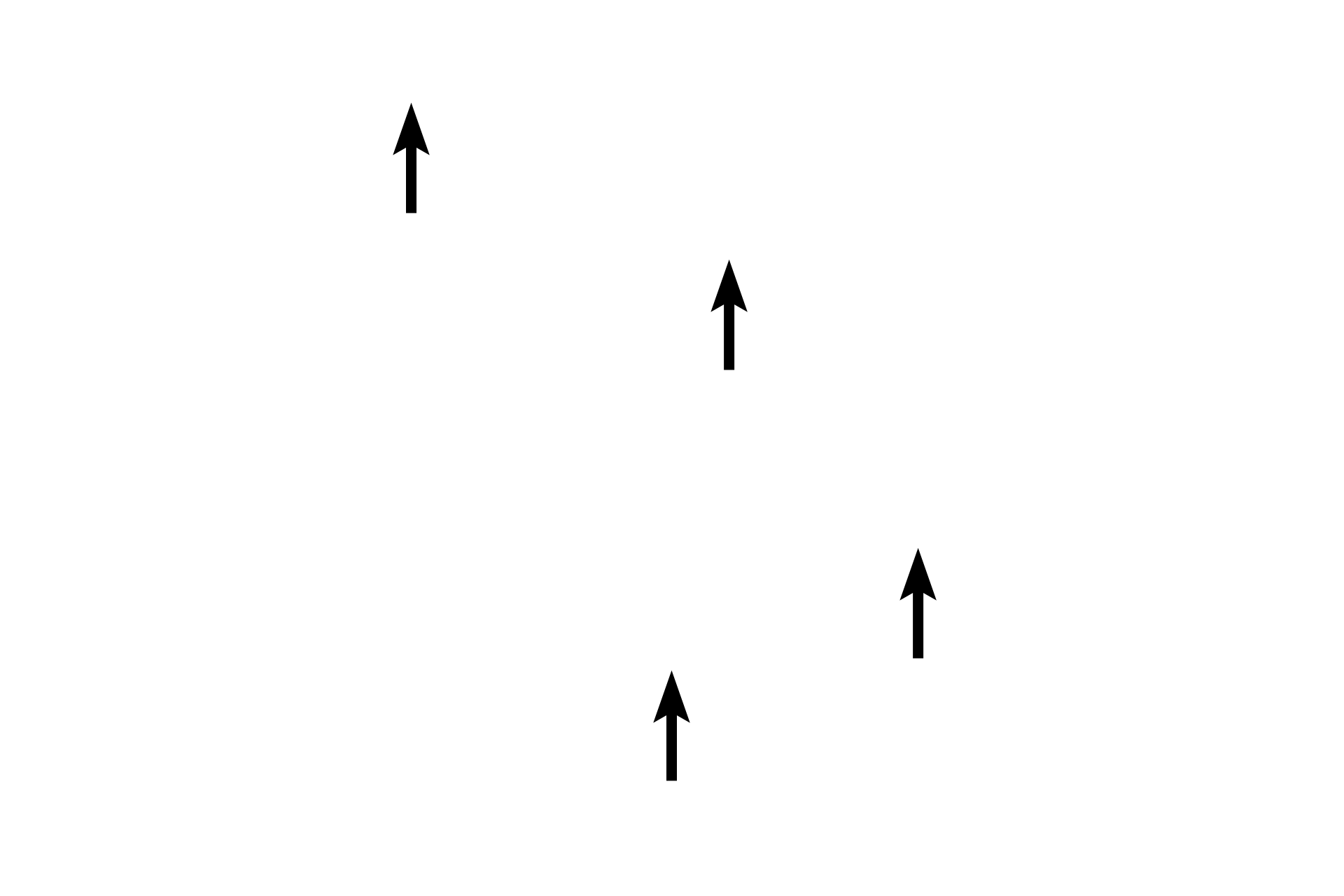 Pinealocytes <p>Higher magnification of the pineal gland shows pinealocytes arranged in poorly defined lobules.  Connective tissue septa, extending from the pia mater capsule, penetrate the parenchyma of the gland.  Also visible is a corpus arenaceum.  200x</p>
