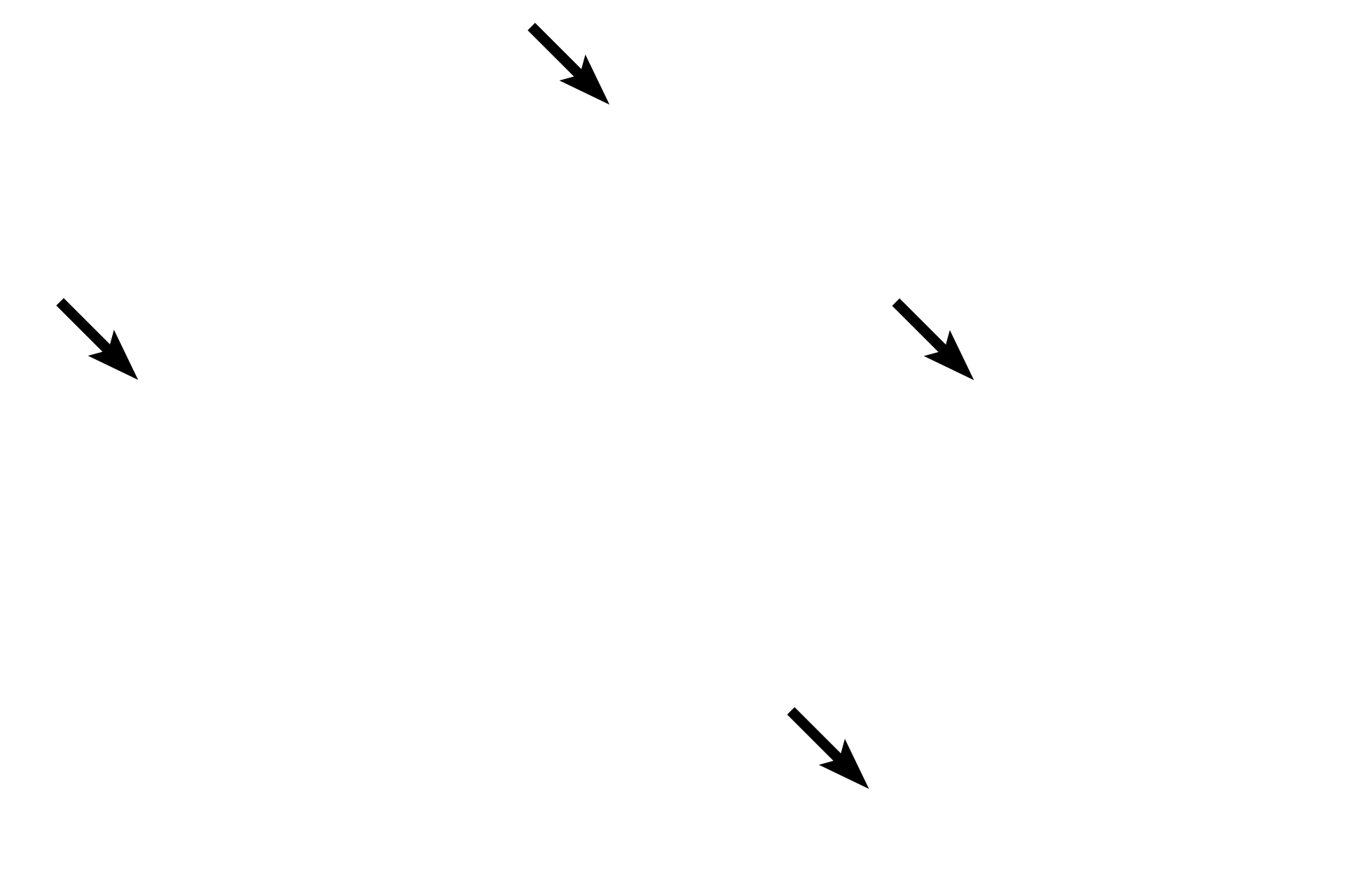 Connective tissue septa <p>Higher magnification of the pineal gland shows pinealocytes arranged in poorly defined lobules.  Connective tissue septa, extending from the pia mater capsule, penetrate the parenchyma of the gland.  Also visible is a corpus arenaceum.  200x</p>
