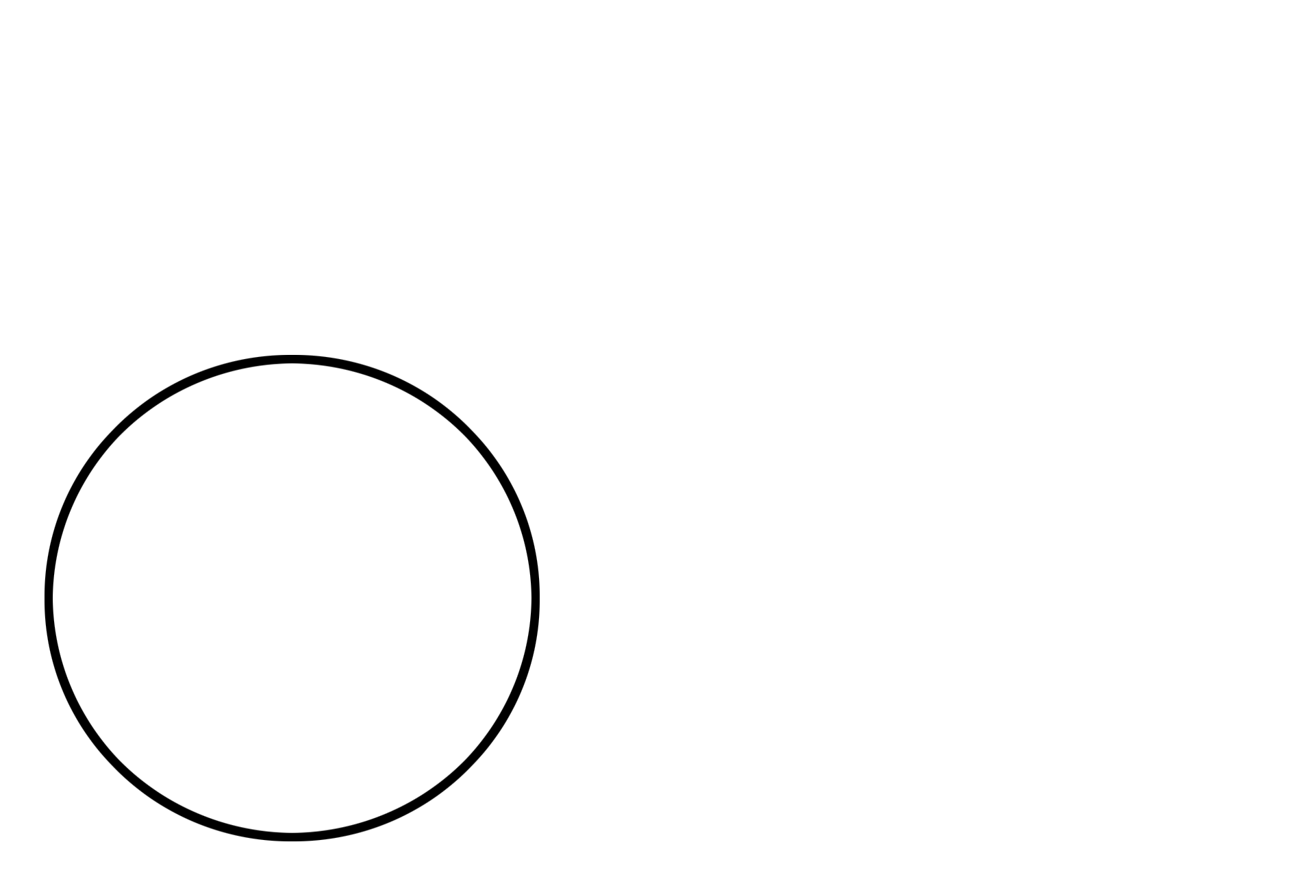 Corpus arenaceum <p>Higher magnification of the pineal gland shows pinealocytes arranged in poorly defined lobules.  Connective tissue septa, extending from the pia mater capsule, penetrate the parenchyma of the gland.  Also visible is a corpus arenaceum.  200x</p>
