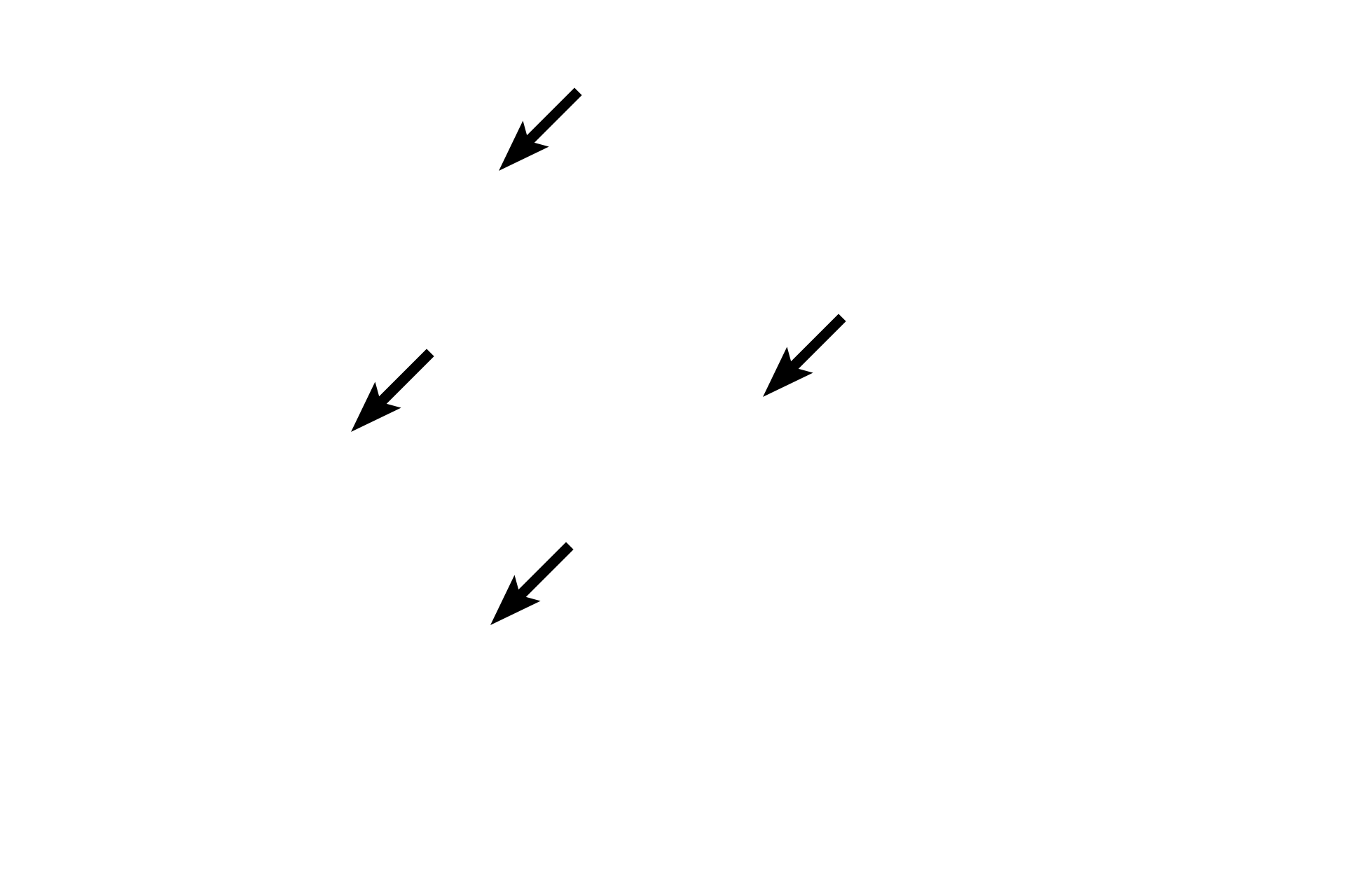 Pinealocytes > <p>The nucleus of a pinealocyte is euchromatic with a prominent nucleolus.  The cytoplasm is not evident with conventional stains; however, the cell generally has two or more extensions similar to neuronal processes.  The main secretory product of pinealocytes is melatonin, which regulates light-dark cycles (circadian rhythms).</p>
