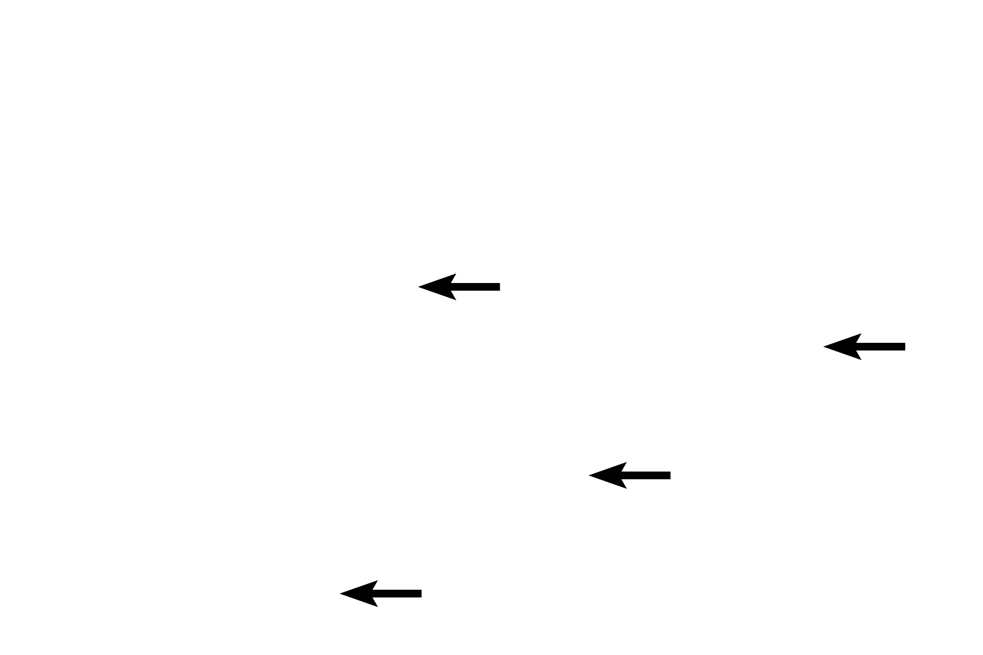 Interstitial cells > <p>Interstitial cells, the minor cell type in the pineal, are modified astrocytes similar to pituicytes in the neurohypophysis.  These cells are located within groups of pinealocytes and in the connective tissue septa.  The nuclei of interstitial cells are more elongated and heterochromatic than those of pinealocytes.</p>
