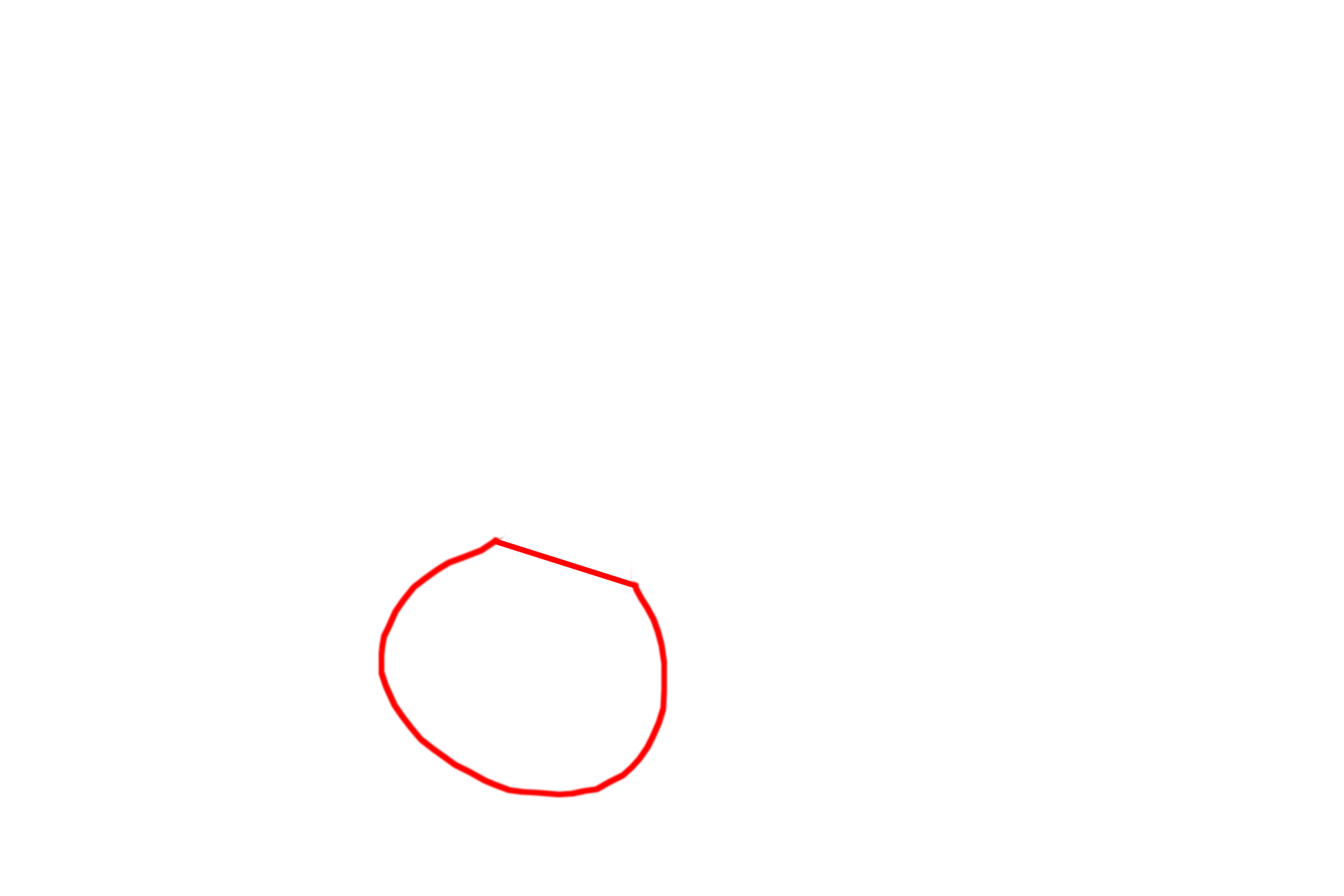  - Pars nervosa <p>The infundibulum connects the hypothalamus with the enlarged terminal portion of the neurohypophysis, the pars nervosa.  The pars nervosa is sometimes referred to as the posterior lobe.  The infundibulum also suspends the adenohypophysis.</p>
