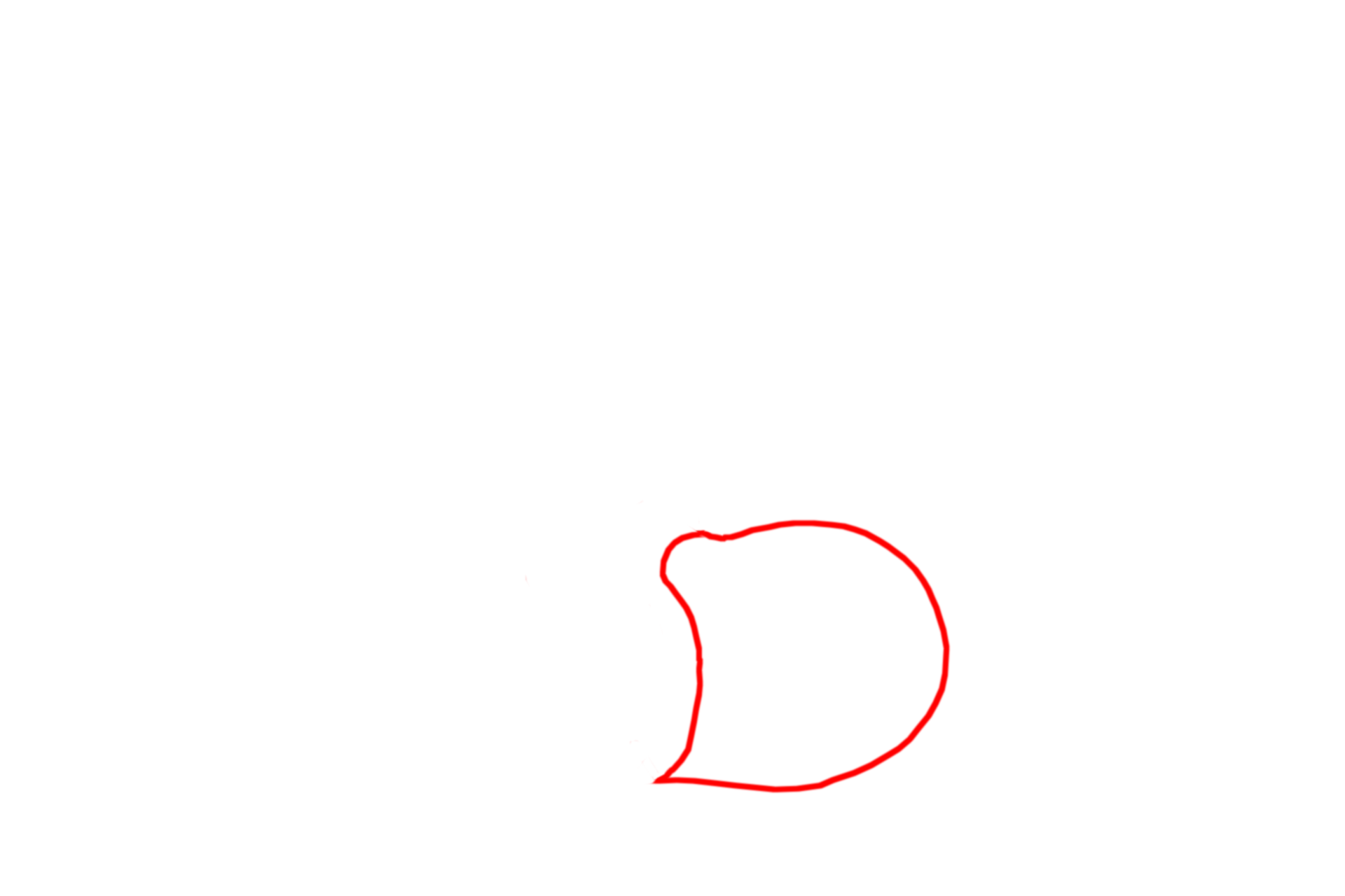  - Pars distalis > <p>The pars distalis is the enlarged anterior wall of Rathke’s pouch and is the largest portion of the adenohypophysis.  It is sometimes referred to as the anterior lobe.  The pars tuberalis extends upward from this main body of the adenohypophysis and forms an incomplete sleeve around the infundibulum.</p>
