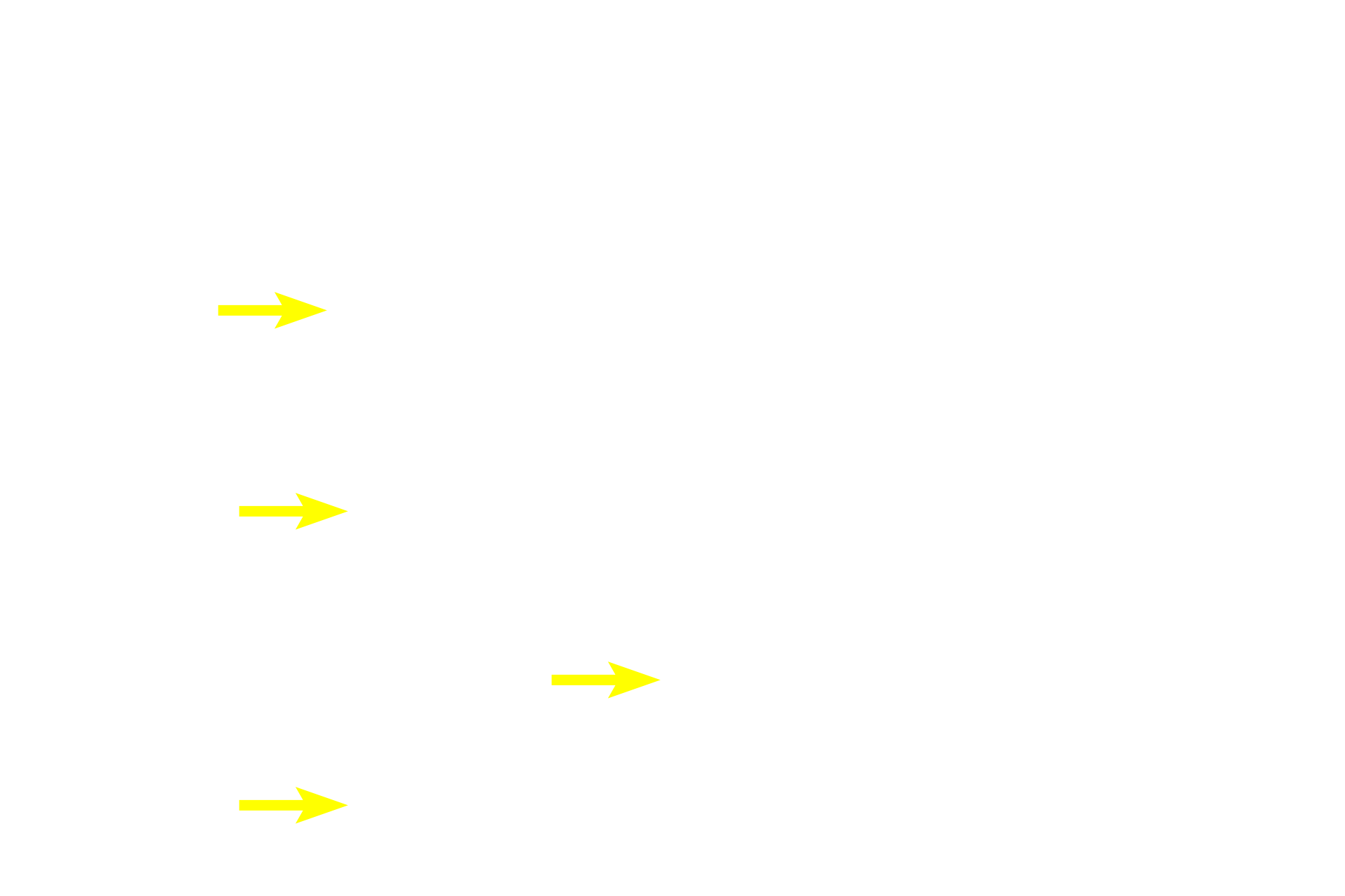 Basophils <p>With this Masson stain, acidophils stain orange, basophils stain greenish-purple and the connective tissue stroma stains green.  Basophils are generally larger than acidophils.  Basophils can be further subdivided into thyrotropes, gonadotropes and adrenocorticotropes.  Acidophils are subdivided into mammotropes and somatotropes.  1000x</p>
