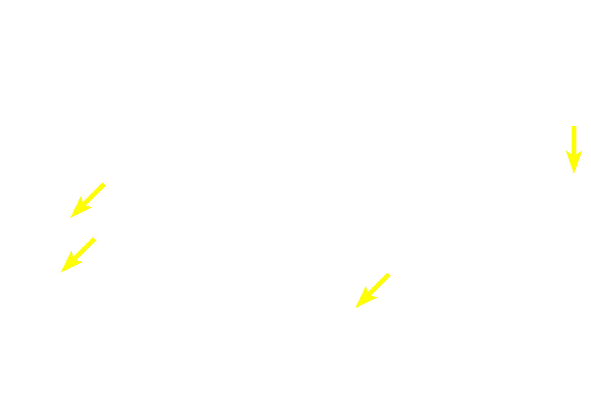 Chromophobes <p>With this Masson stain, acidophils stain orange, basophils stain greenish-purple and the connective tissue stroma stains green.  Basophils are generally larger than acidophils.  Basophils can be further subdivided into thyrotropes, gonadotropes and adrenocorticotropes.  Acidophils are subdivided into mammotropes and somatotropes.  1000x</p>
