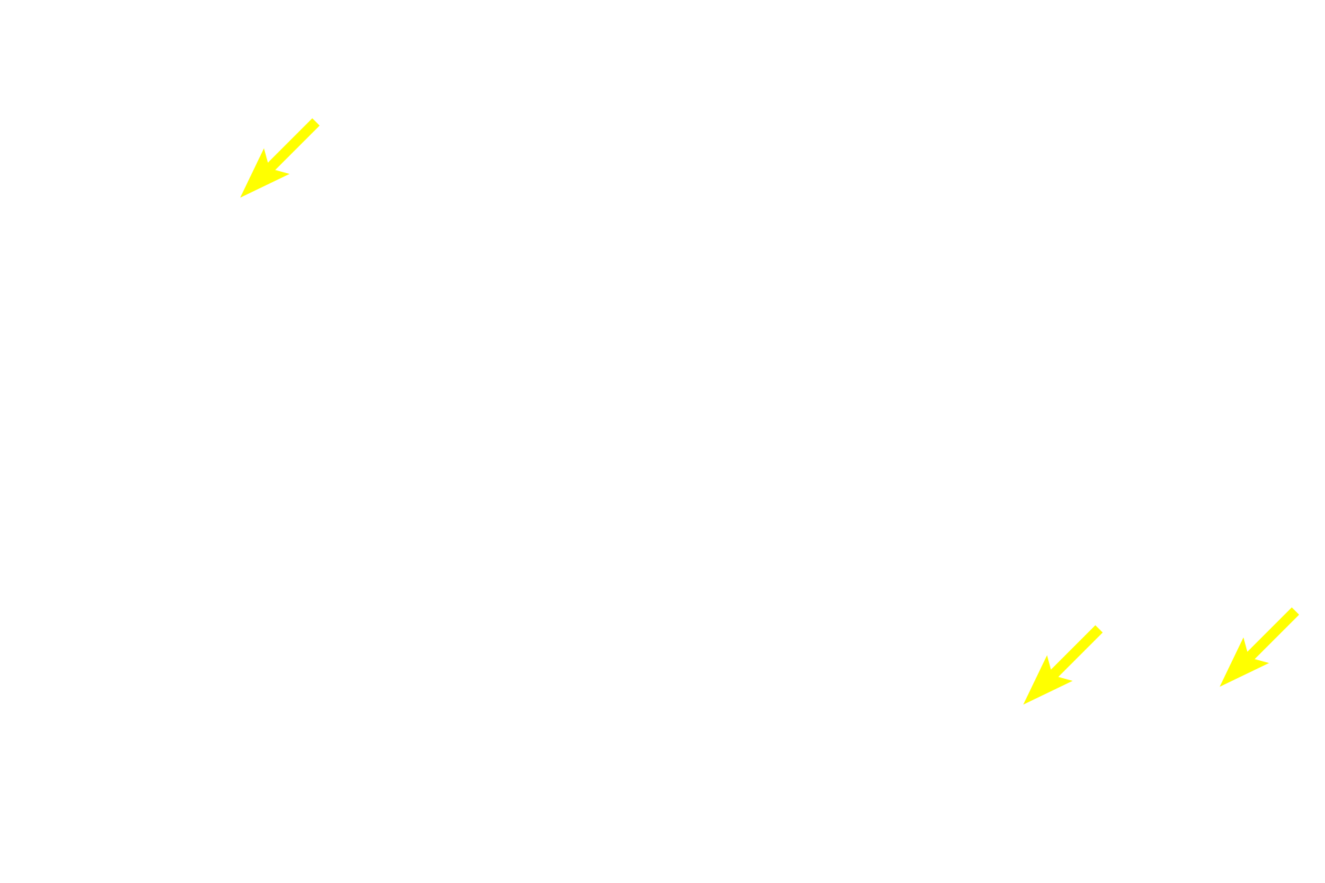 Connective tissue <p>With this Masson stain, acidophils stain orange, basophils stain greenish-purple and the connective tissue stroma stains green.  Basophils are generally larger than acidophils.  Basophils can be further subdivided into thyrotropes, gonadotropes and adrenocorticotropes.  Acidophils are subdivided into mammotropes and somatotropes.  1000x</p>
