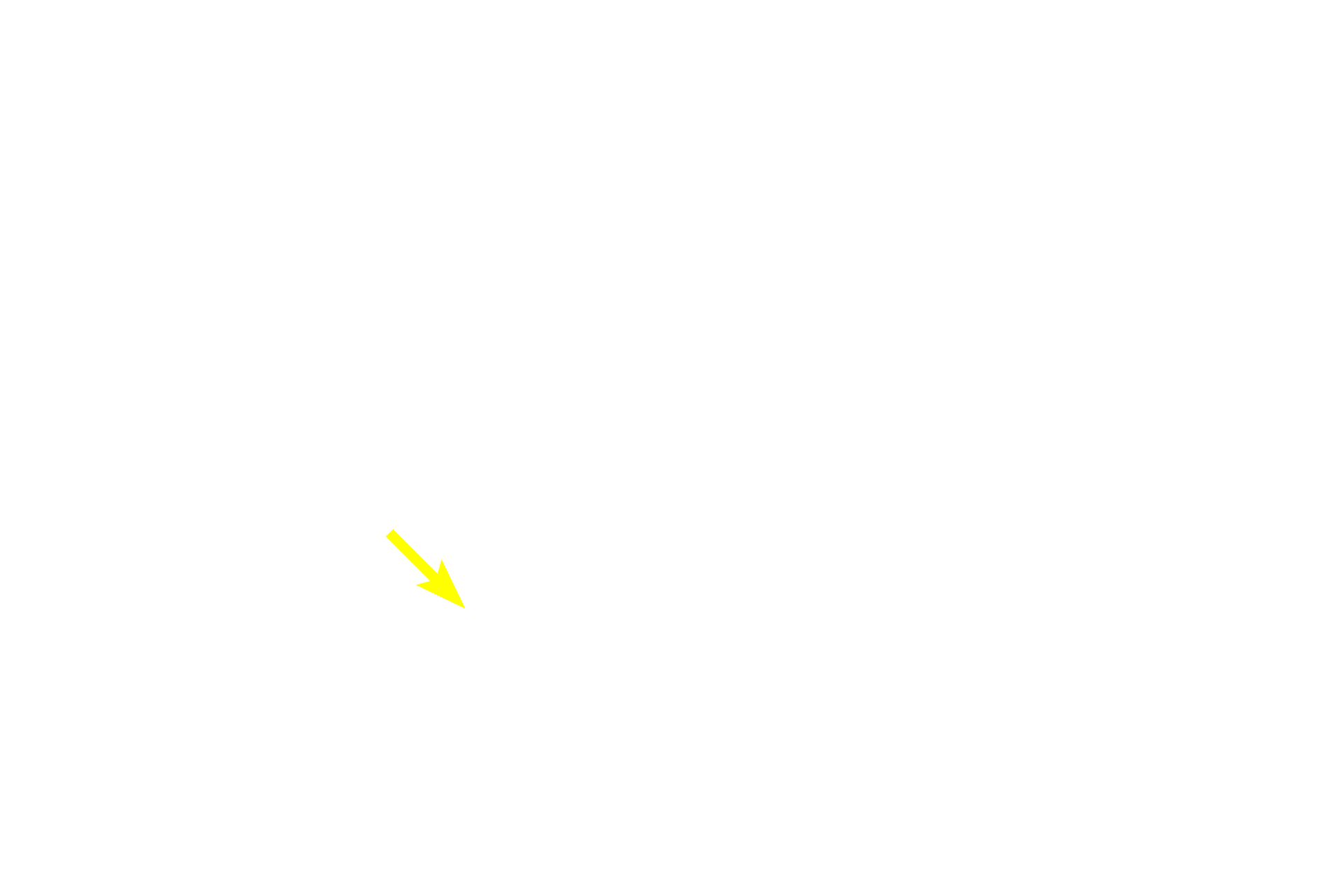 Capillary <p>With this Masson stain, acidophils stain orange, basophils stain greenish-purple and the connective tissue stroma stains green.  Basophils are generally larger than acidophils.  Basophils can be further subdivided into thyrotropes, gonadotropes and adrenocorticotropes.  Acidophils are subdivided into mammotropes and somatotropes.  1000x</p>
