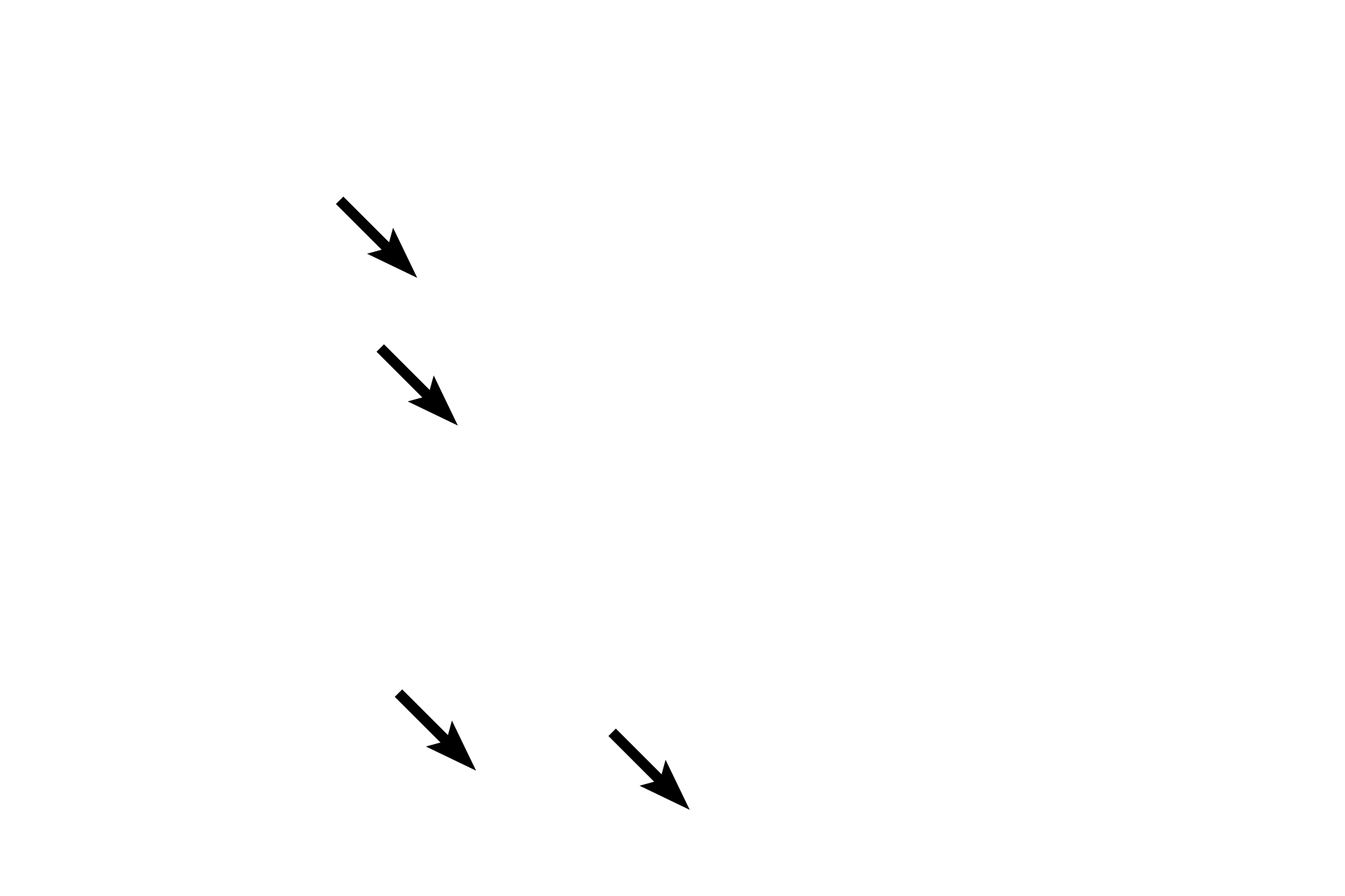  - Axon bundles <p>The pars intermedia of the adenohypophysis lies adjacent to the pars nervosa and to the colloid-filled, cystic remnants of Rathke’s pouch.  Cells of this subdivision also migrate into the pars nervosa.  The pars intermedia, which is rudimentary in humans, is composed exclusively of basophils.  200x</p>
