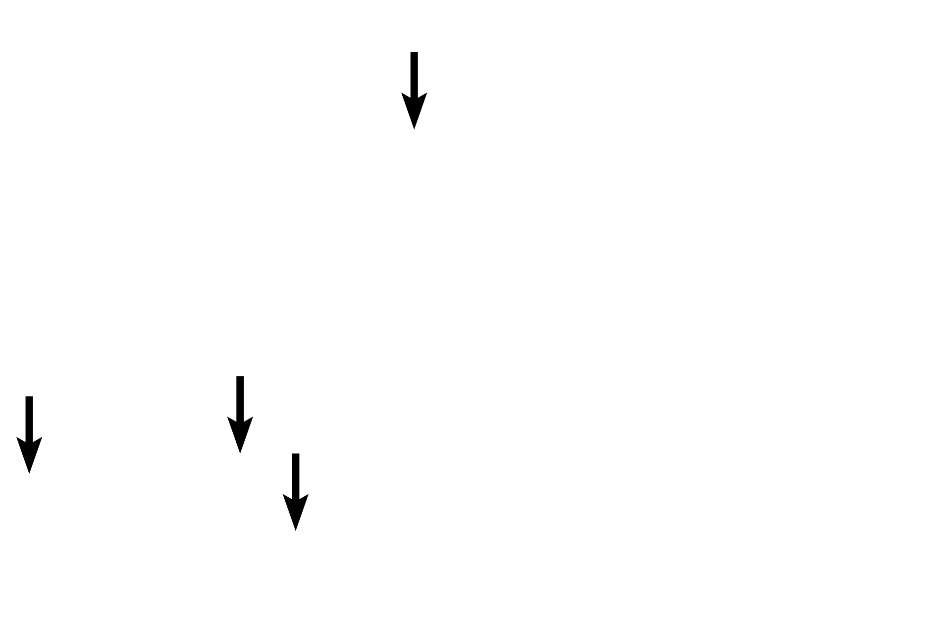  - Herring bodies <p>The pars intermedia of the adenohypophysis lies adjacent to the pars nervosa and to the colloid-filled, cystic remnants of Rathke’s pouch.  Cells of this subdivision also migrate into the pars nervosa.  The pars intermedia, which is rudimentary in humans, is composed exclusively of basophils.  200x</p>
