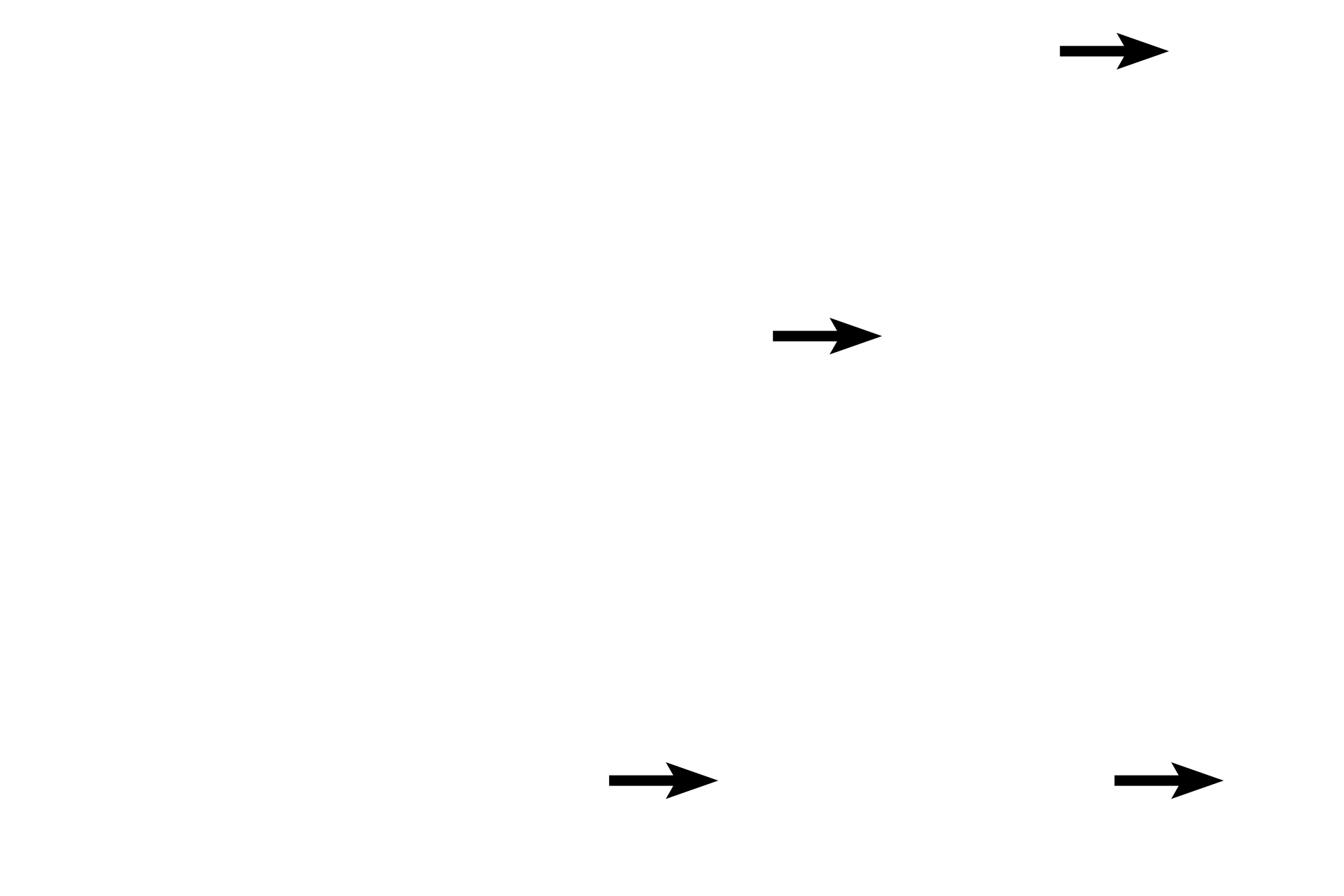  - Basophils of the pars intermedia <p>The interface of pars nervosa and pars intermedia shows remnants of Rathke’s pouch. In this section, the colloid of the cysts was lost in tissue processing.  Basophils of the pars intermedia, lying adjacent to the cysts, are adrenocorticotropes.  Visible in the pars nervosa are thin, unmyelinated hypothalamic axons, which end in variously-sized Herring bodies.  1000x</p>
