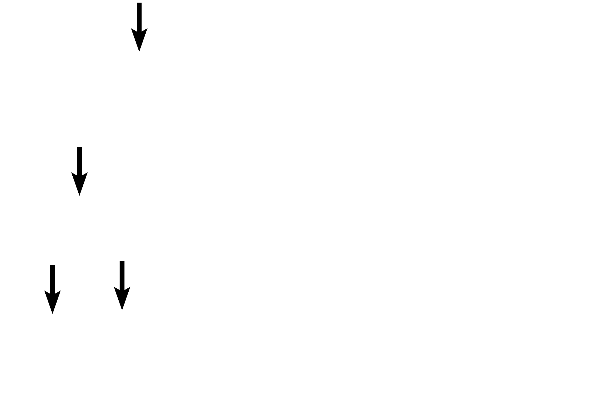  - Herring bodies <p>The interface of pars nervosa and pars intermedia shows remnants of Rathke’s pouch. In this section, the colloid of the cysts was lost in tissue processing.  Basophils of the pars intermedia, lying adjacent to the cysts, are adrenocorticotropes.  Visible in the pars nervosa are thin, unmyelinated hypothalamic axons, which end in variously-sized Herring bodies.  1000x</p>
