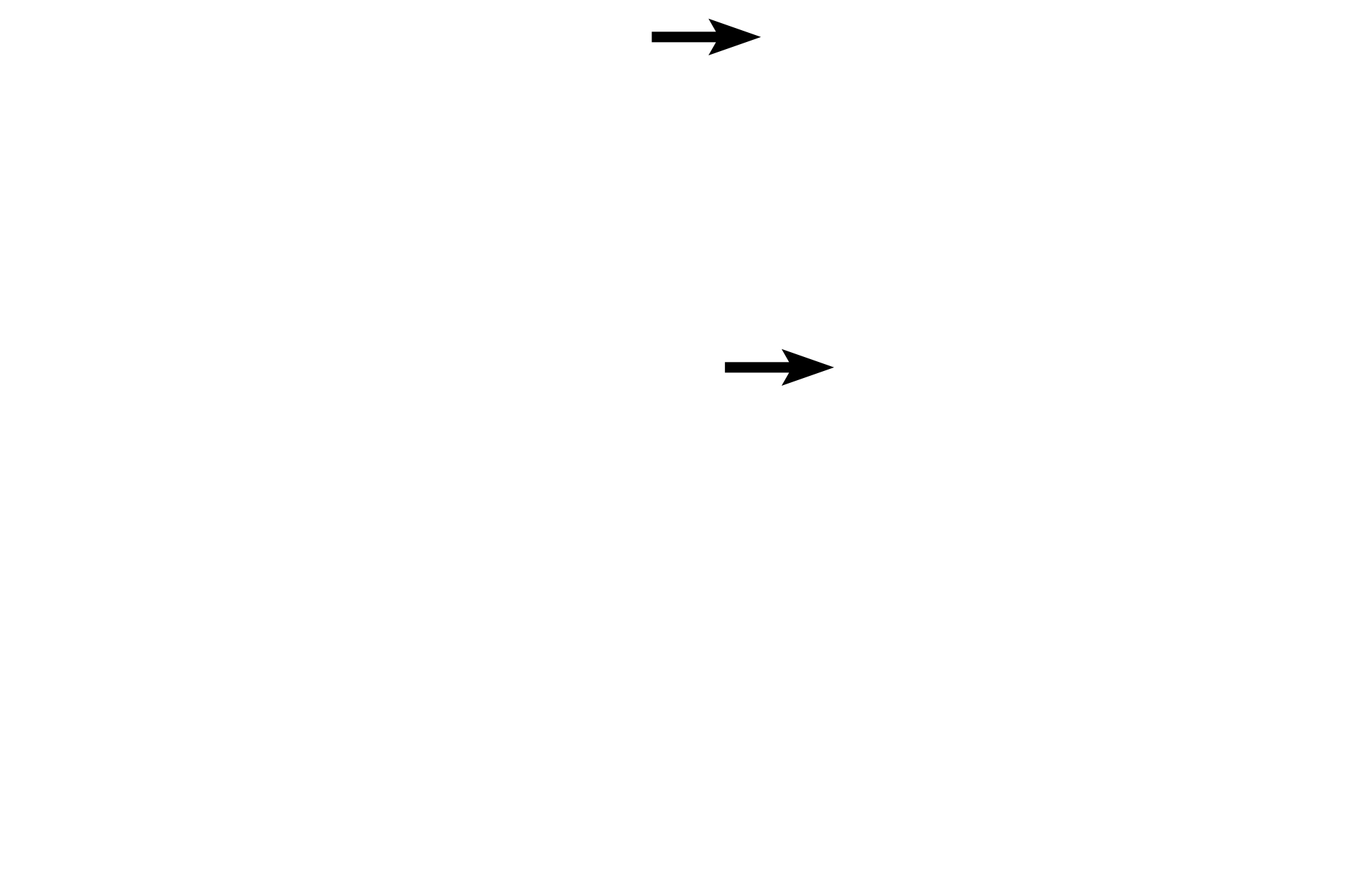 Capillaries <p>The interface of pars nervosa and pars intermedia shows remnants of Rathke’s pouch. In this section, the colloid of the cysts was lost in tissue processing.  Basophils of the pars intermedia, lying adjacent to the cysts, are adrenocorticotropes.  Visible in the pars nervosa are thin, unmyelinated hypothalamic axons, which end in variously-sized Herring bodies.  1000x</p>
