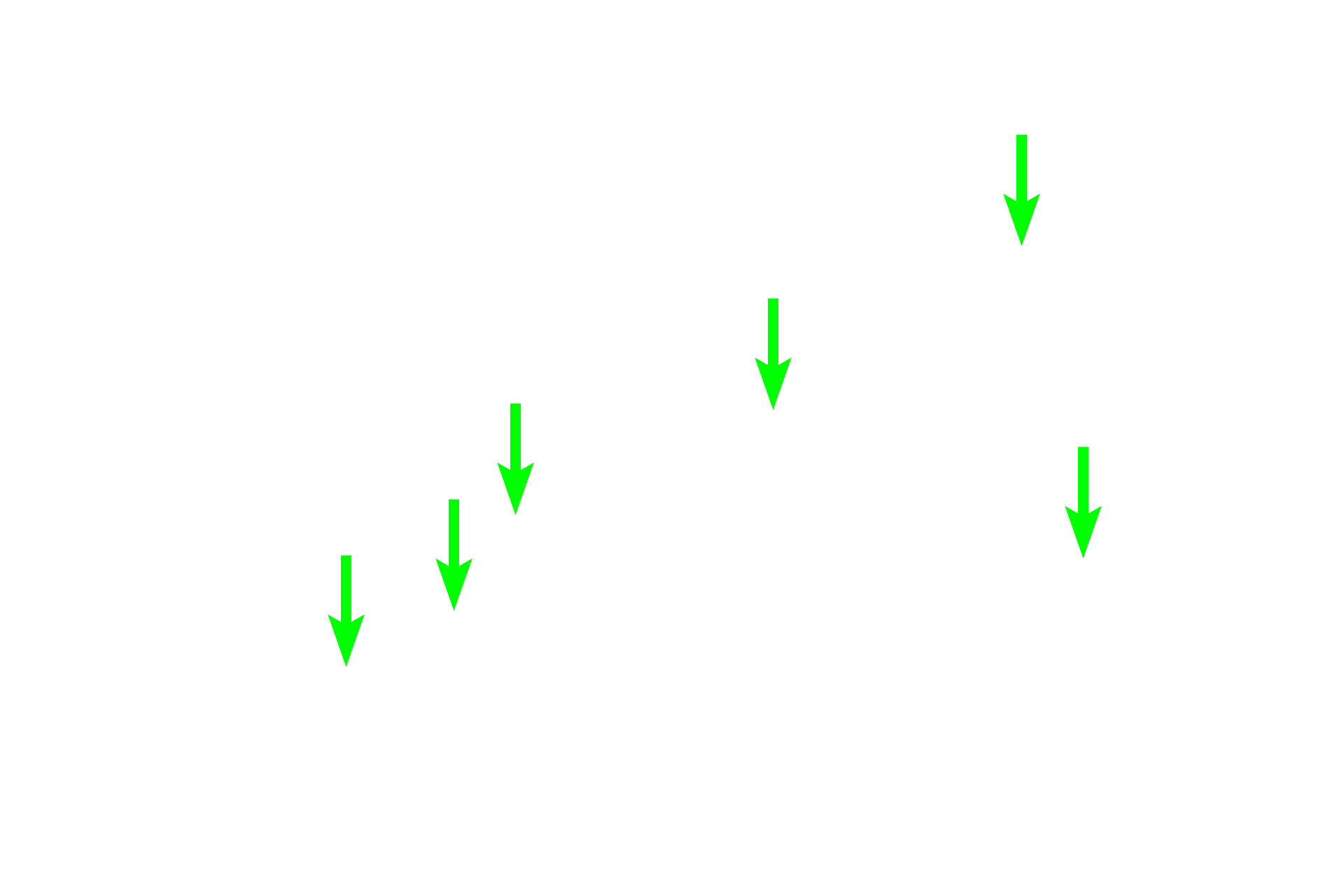 Herring bodies <p>Herring bodies are expanded axon terminals of supraoptic and paraventricular hypothalamic neurons.  Herring bodies are primarily located in the pars nervosa and are filled with secretory granules containing the hormones vasopressin or oxytocin.  Herring bodies are variously sized, eosinophilic, and oval to spherical in shape.  400x</p>
