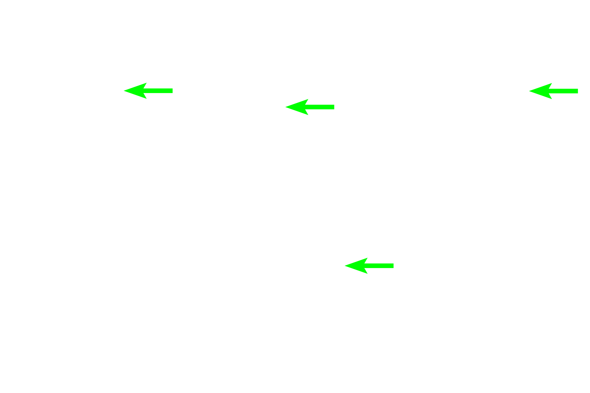 Unmyelinated axons <p>Herring bodies are expanded axon terminals of supraoptic and paraventricular hypothalamic neurons.  Herring bodies are primarily located in the pars nervosa and are filled with secretory granules containing the hormones vasopressin or oxytocin.  Herring bodies are variously sized, eosinophilic, and oval to spherical in shape.  400x</p>
